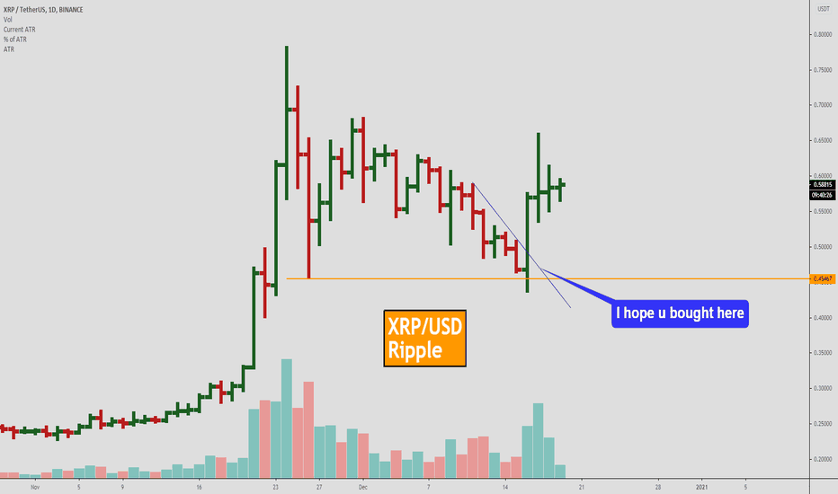 How to trade XRP. 3 Best and simpliest trading strategies.