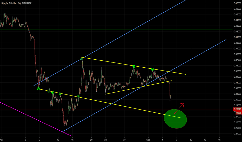 XRP is in a game of NO PAIN, NO GAIN