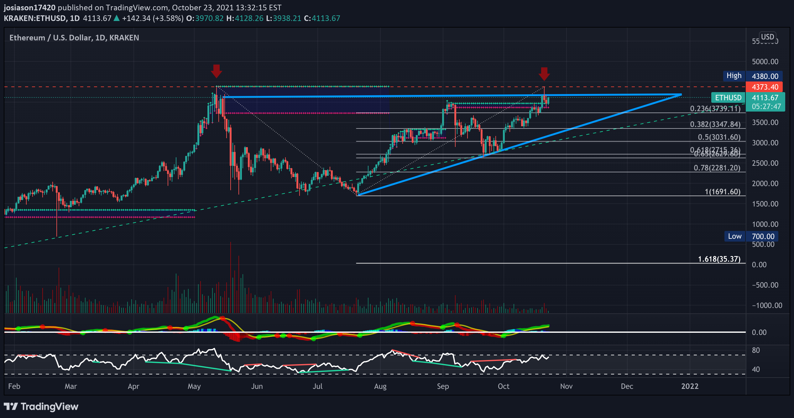 KRAKEN:ETHUSD Idea Chart Image by jacobosiason7
