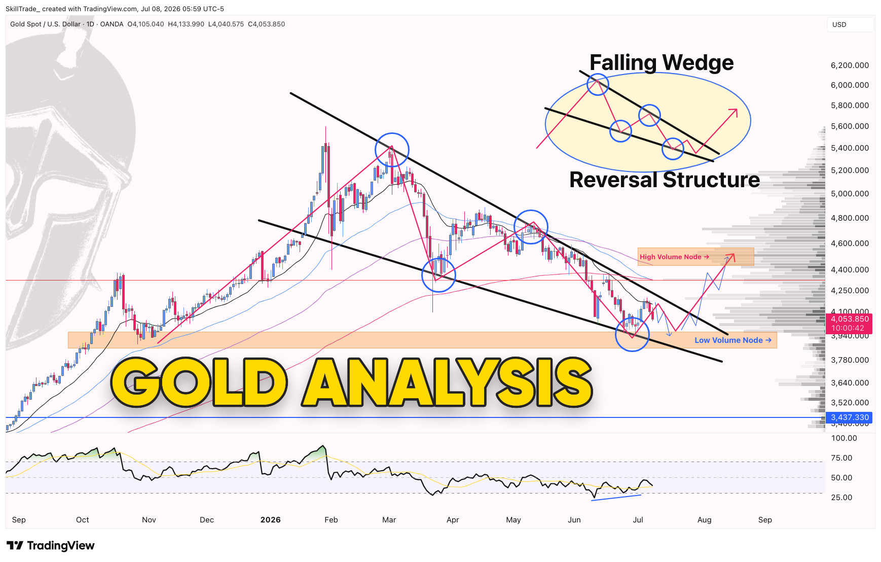 OANDA:XAUUSD Chart Image by SkillTrade_