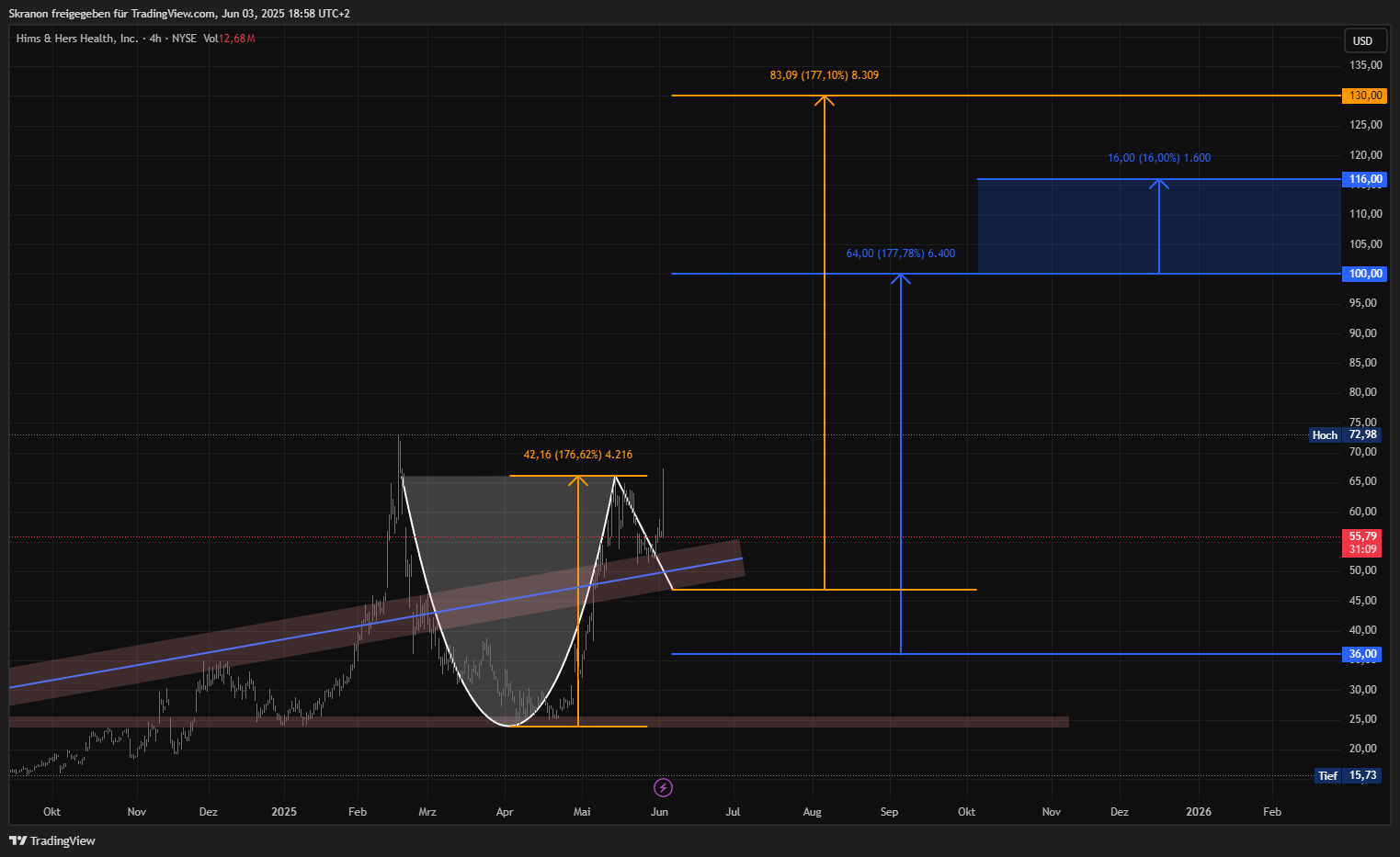 BATS:HIMS Chart Image by Skranon
