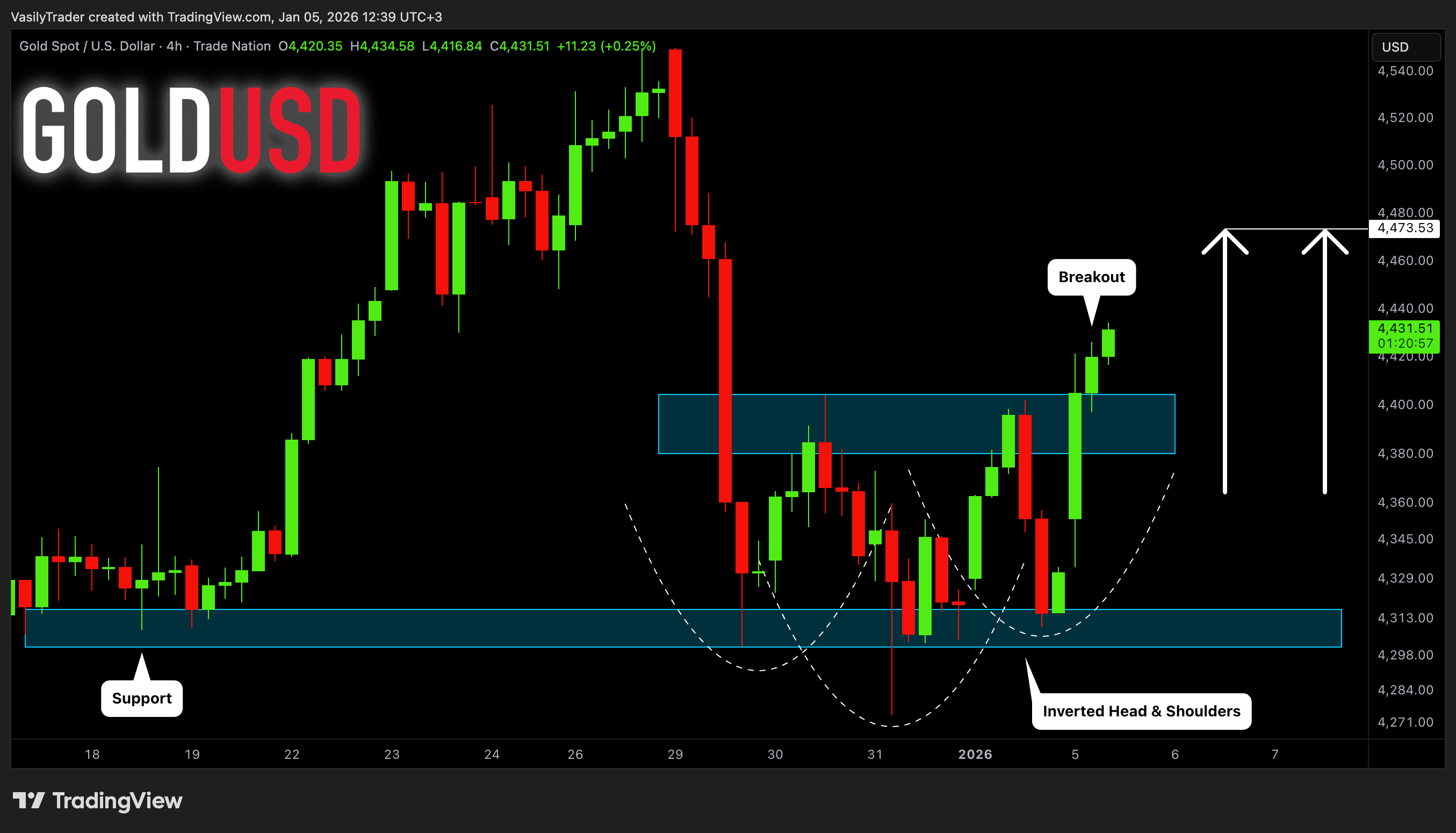 TRADENATION:XAUUSD Chart Image by VasilyTrader