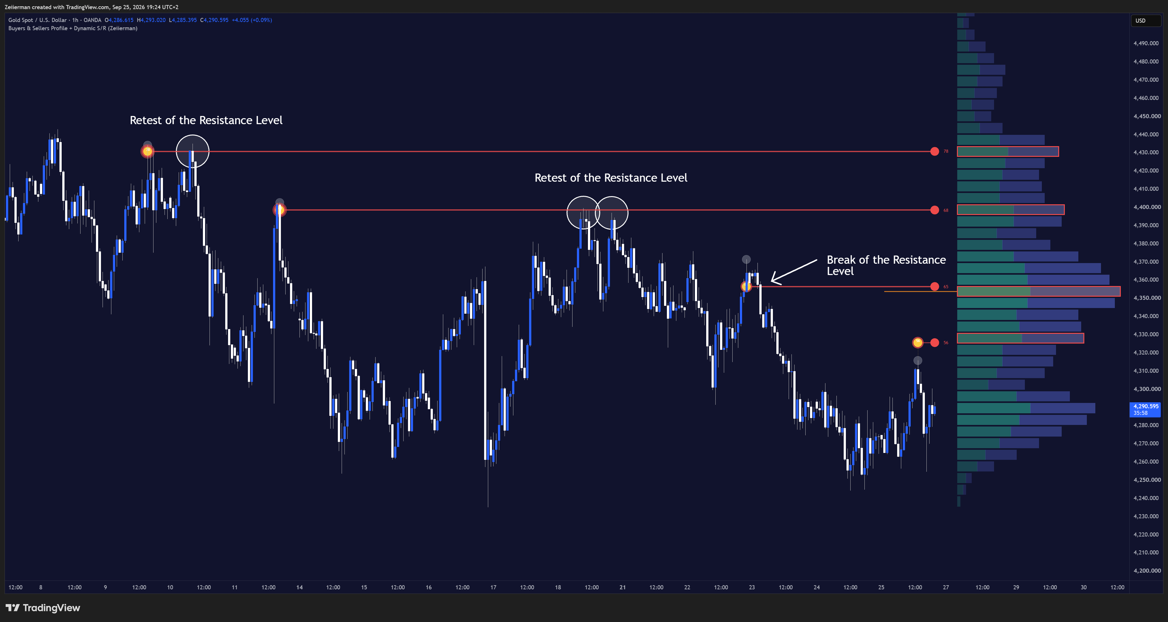 OANDA:XAUUSD Chart Image by Zeiierman