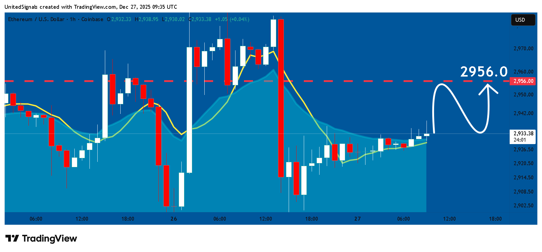 COINBASE:ETHUSD Chart Image by UnitedSignals