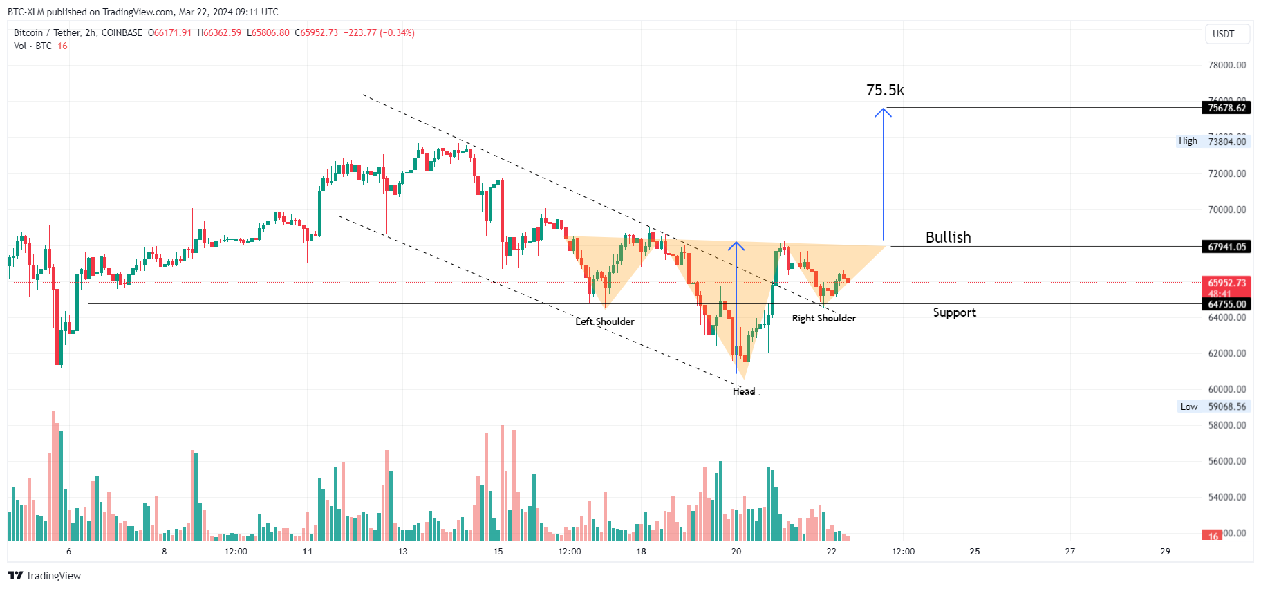 COINBASE:BTCUSDTチャート画像 - BTC-XLMの投稿