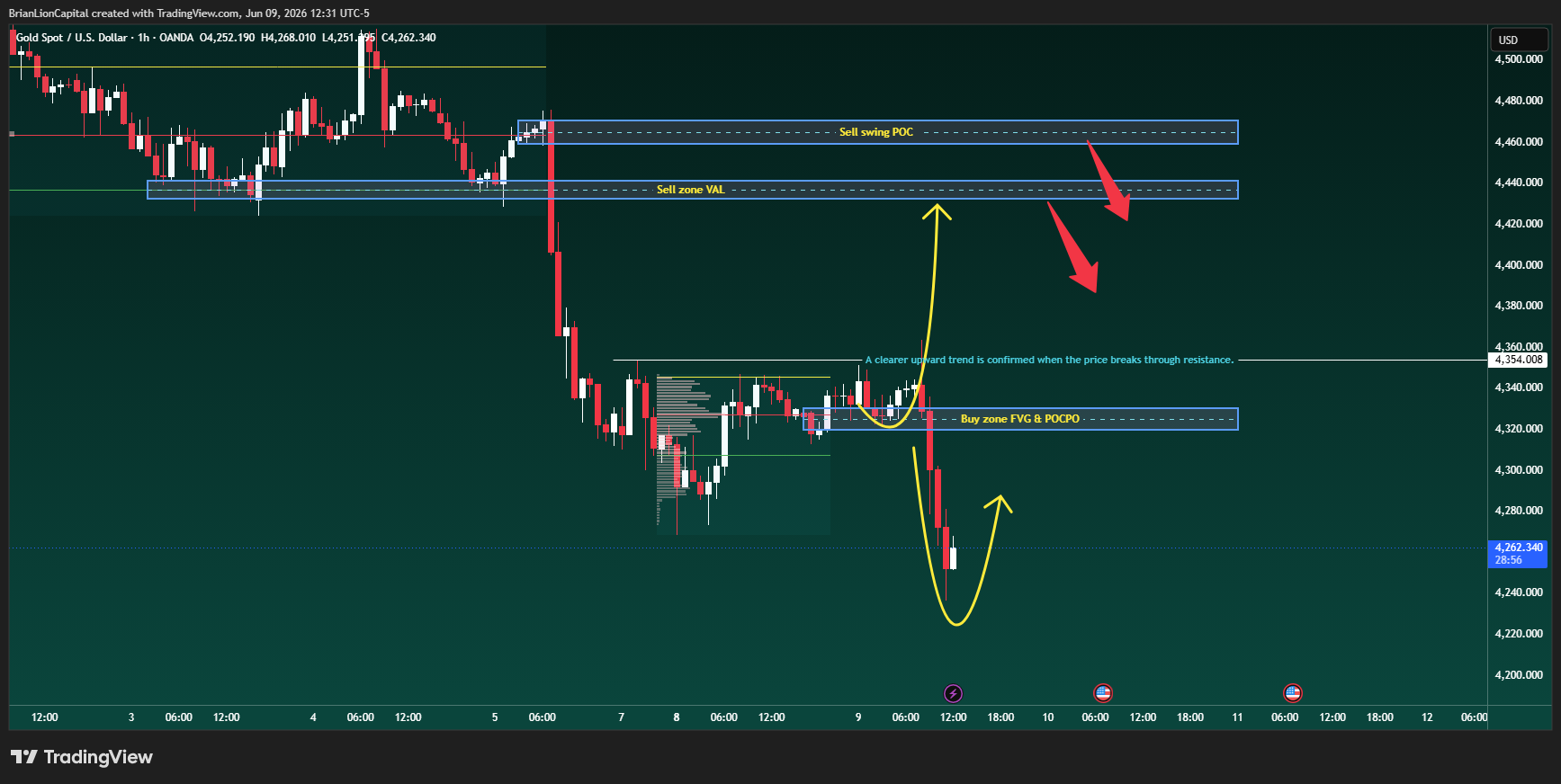OANDA:XAUUSD Chart Image by BrianLionCapital