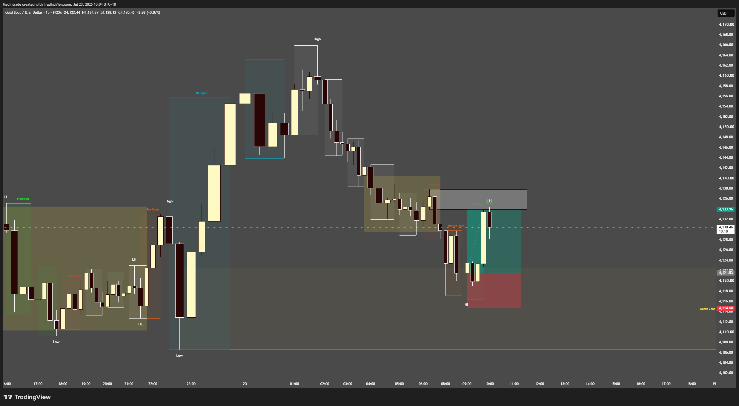 FX:XAUUSD Chart Image by Medintrade