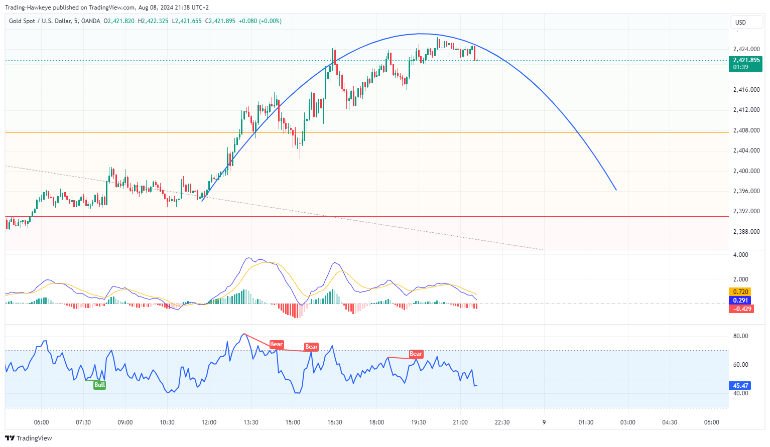 OANDA:XAUUSD Chart Image by alongwineer