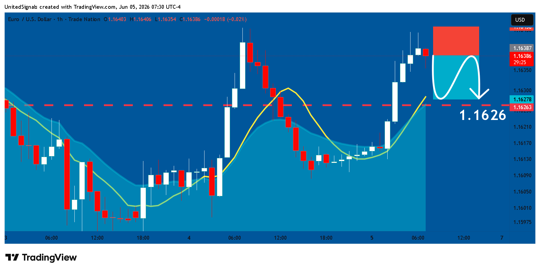 TRADENATION:EURUSD Chart Image by UnitedSignals