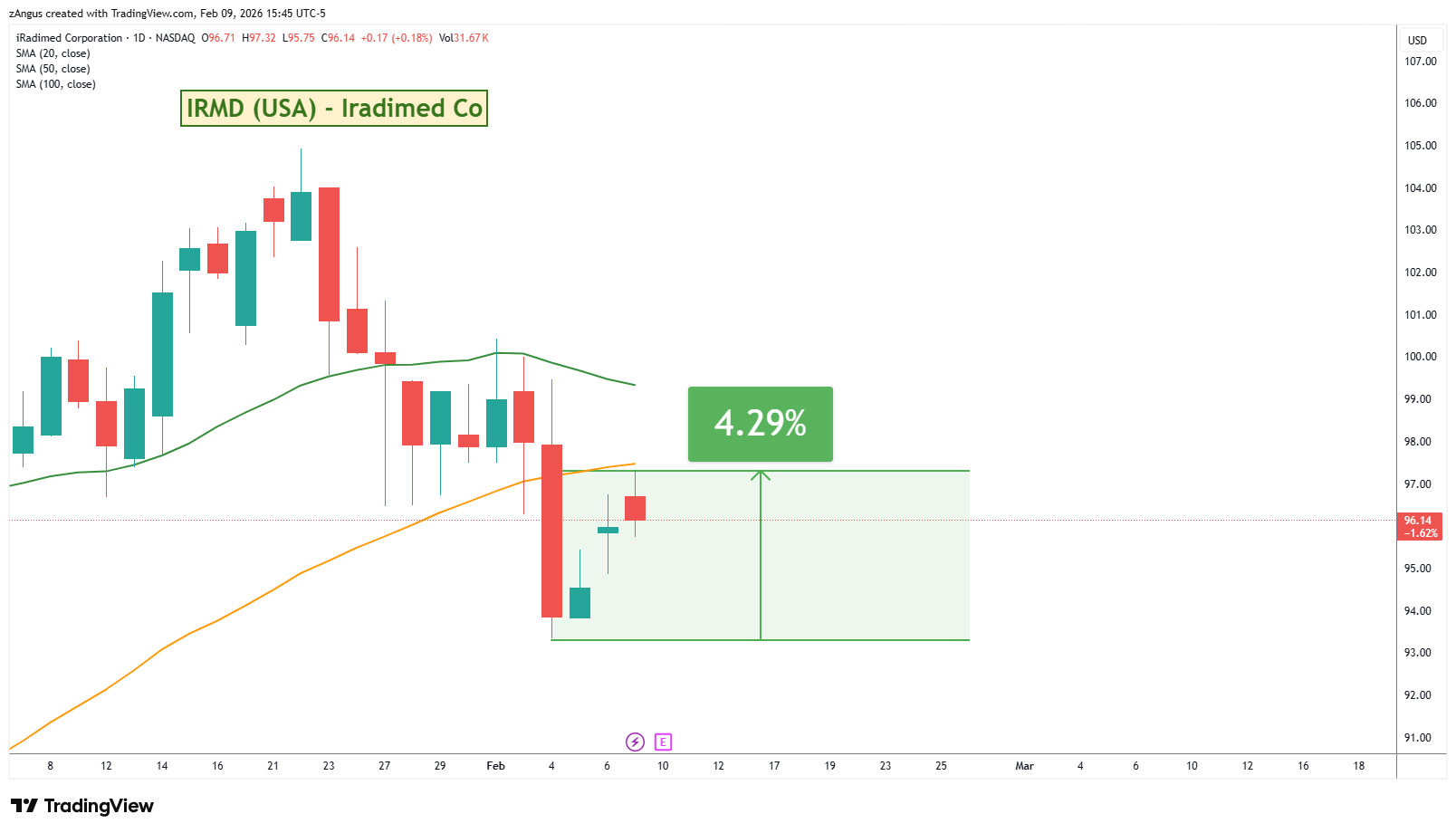 NASDAQ:IRMD 圖表圖片 由 zAngus 提供