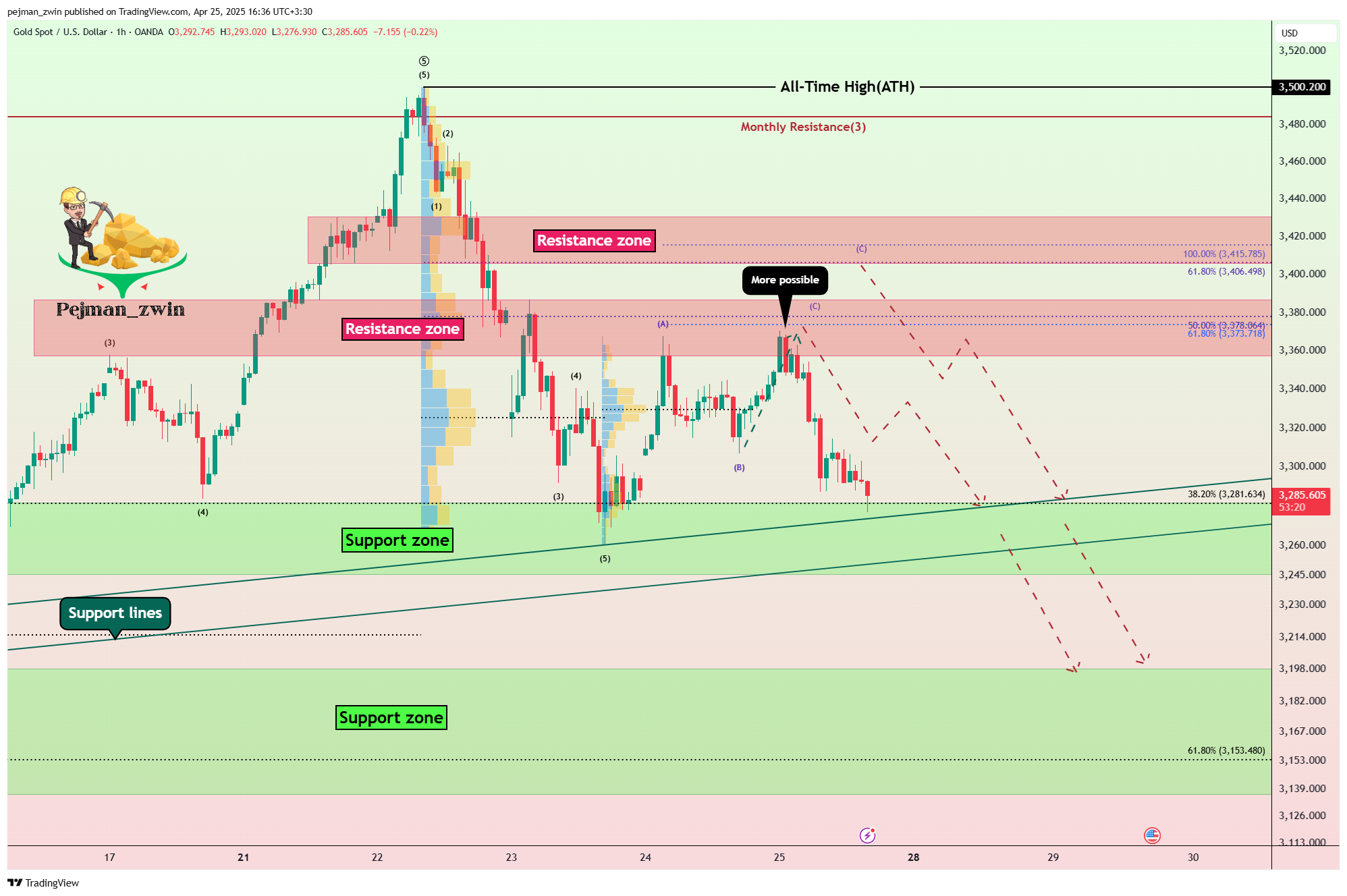 OANDA:XAUUSD Chart Image by pejman_zwin