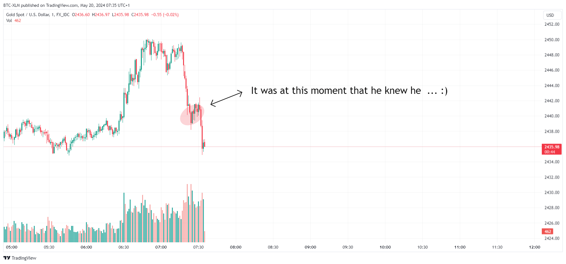 FX_IDC:XAUUSD Chart Image by BTC-XLM