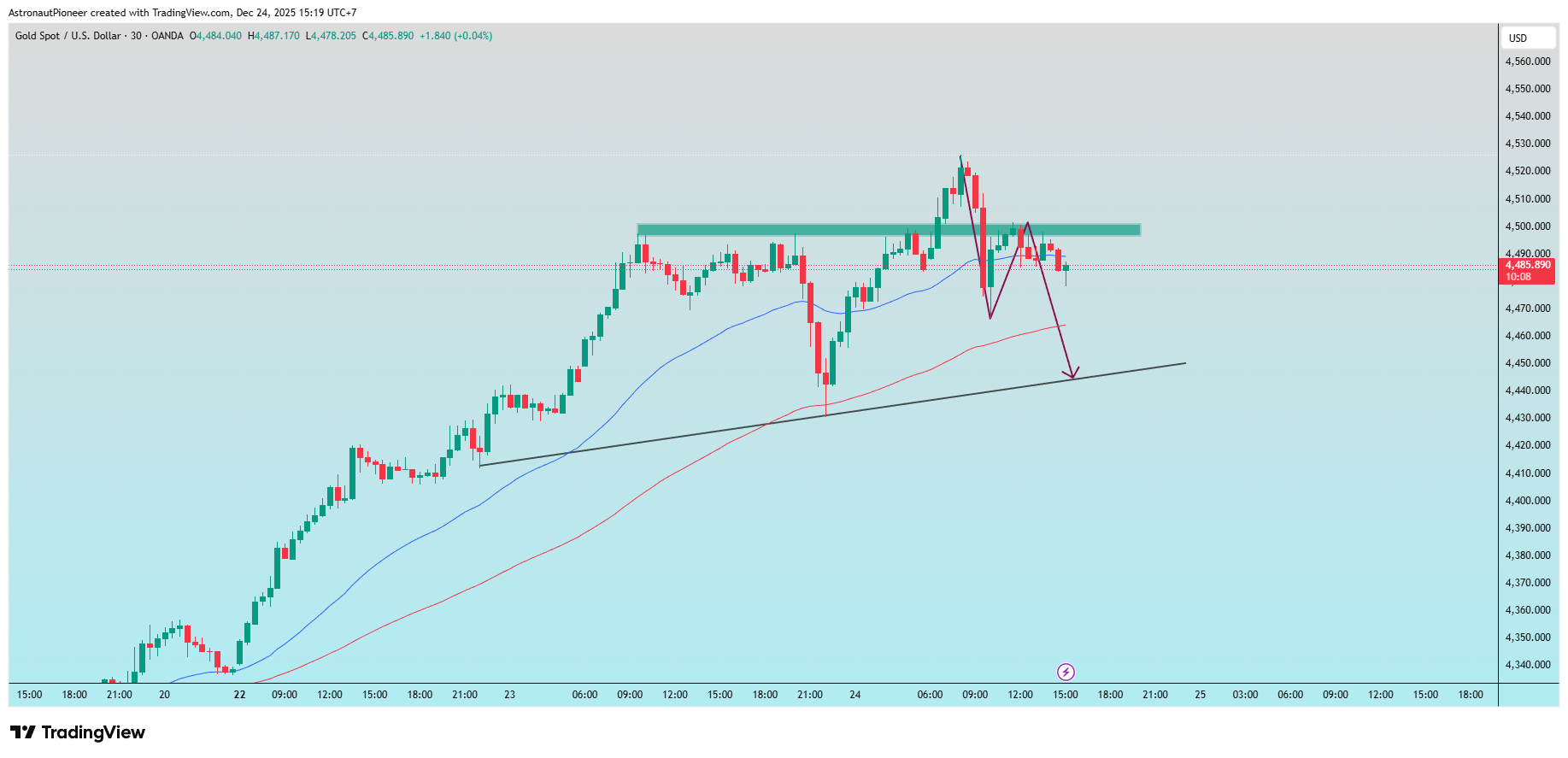 OANDA:XAUUSD Chart Image by AstronautPioneer