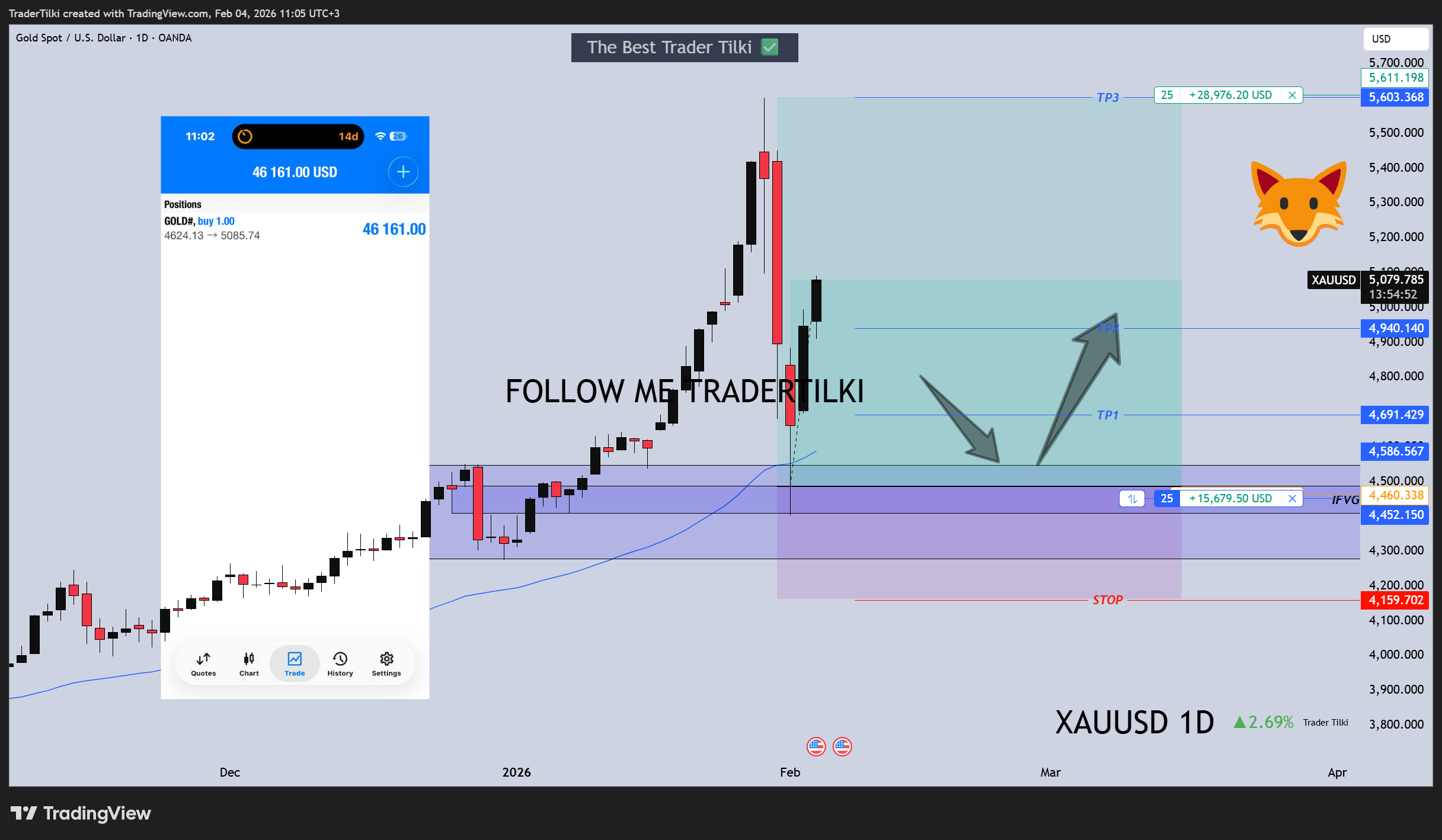 OANDA:XAUUSD Chart Image by TraderTilki