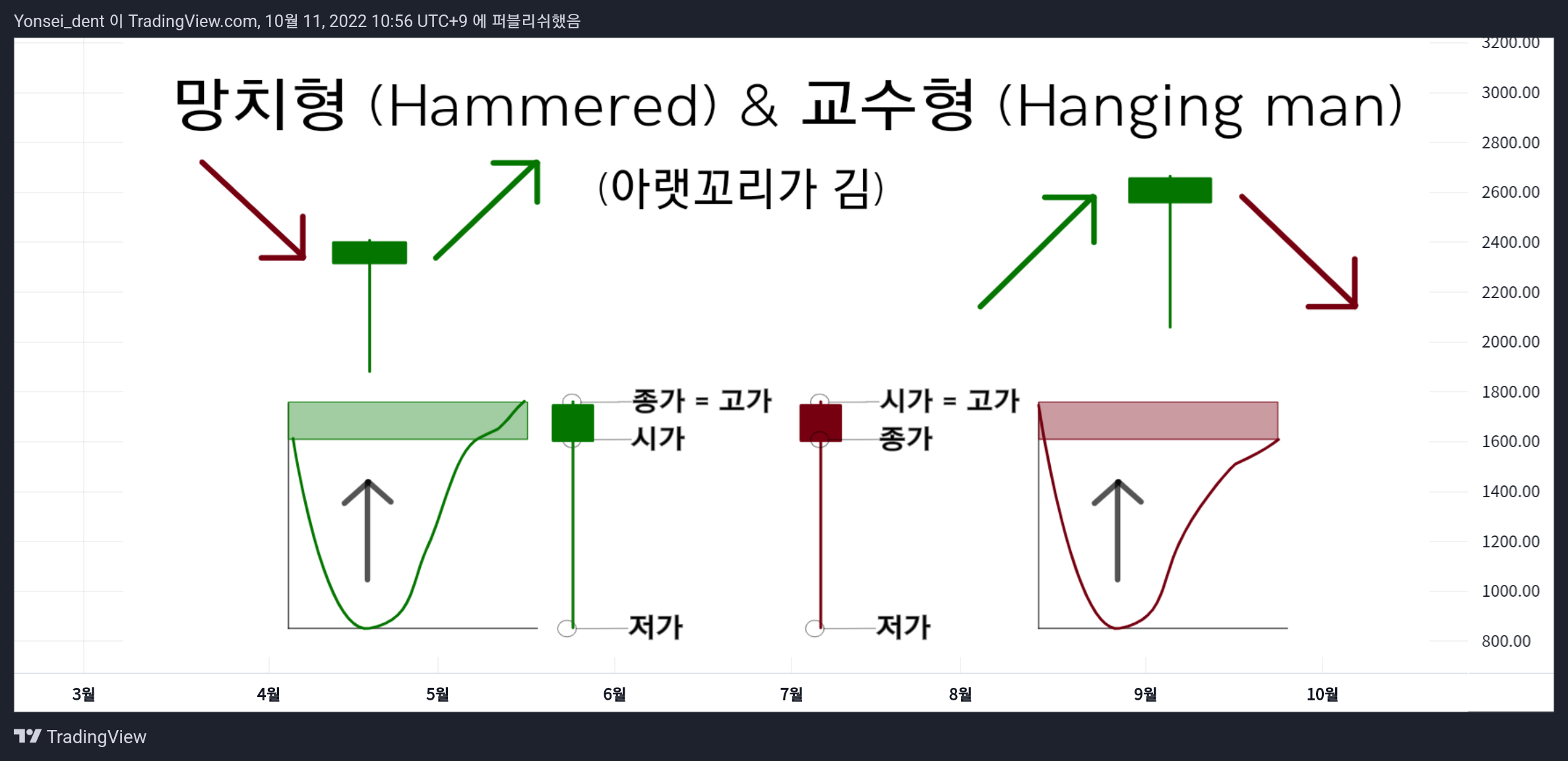 TVC:GOLD Chart Image by Yonsei_dent