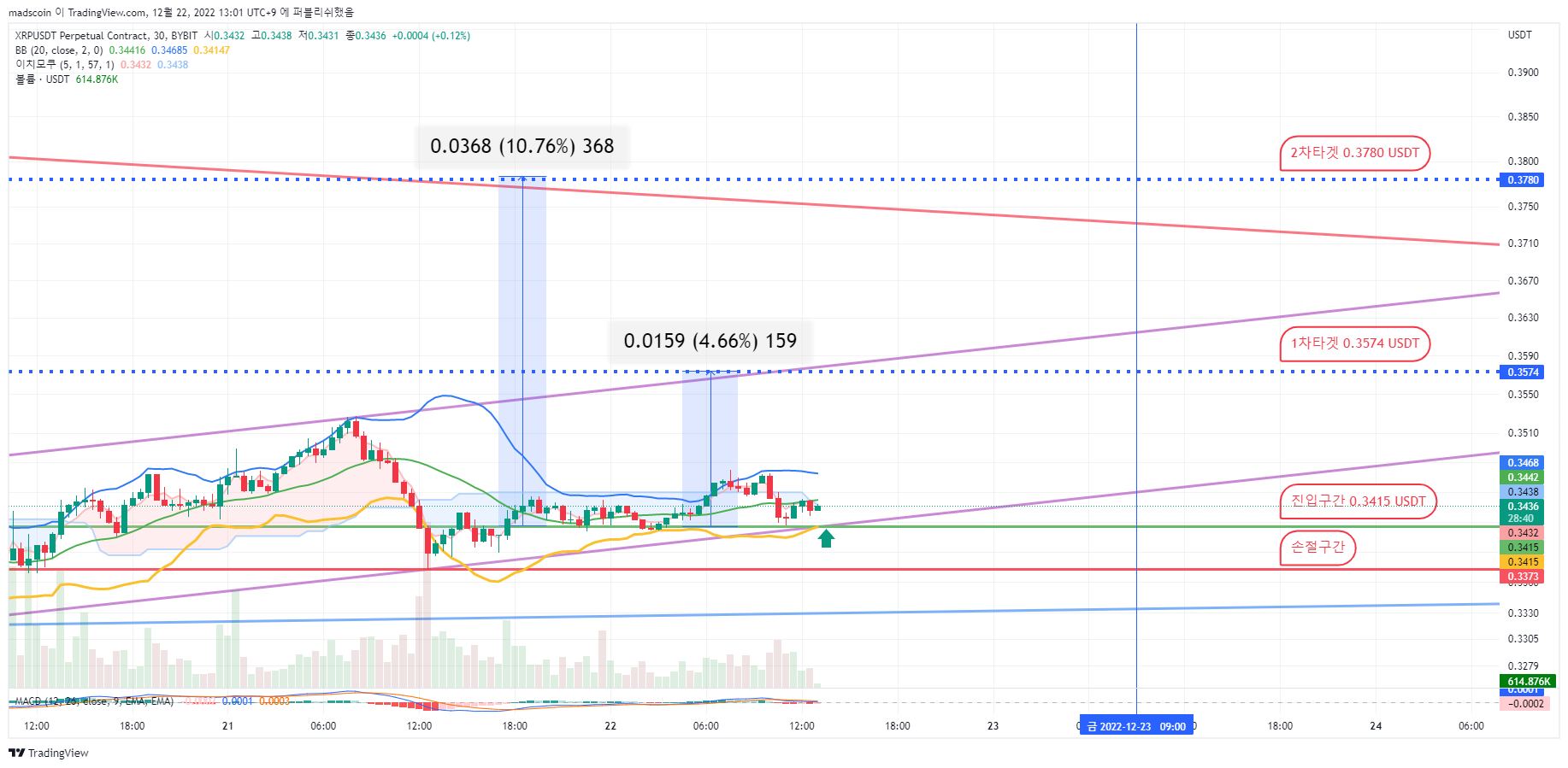 BYBIT:XRPUSDT.P Chart Image by madscoin