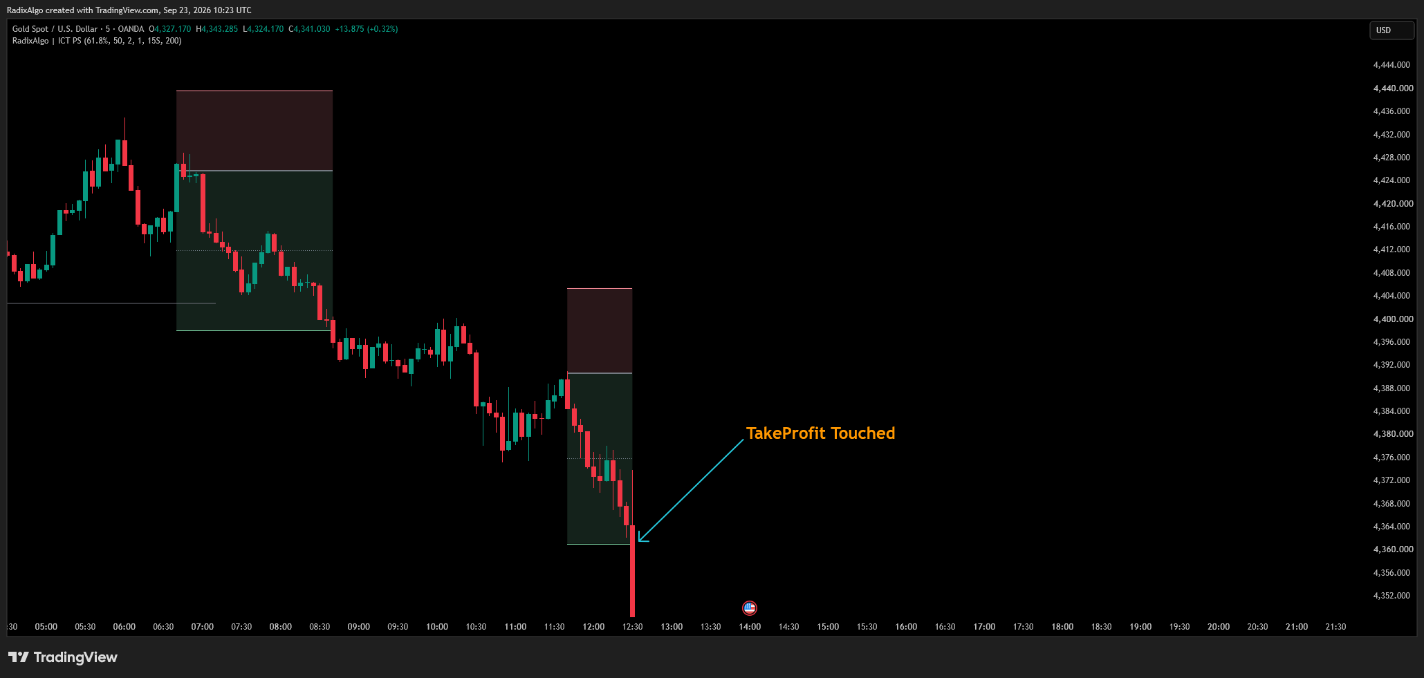OANDA:XAUUSD Chart Image by RadixAlgo