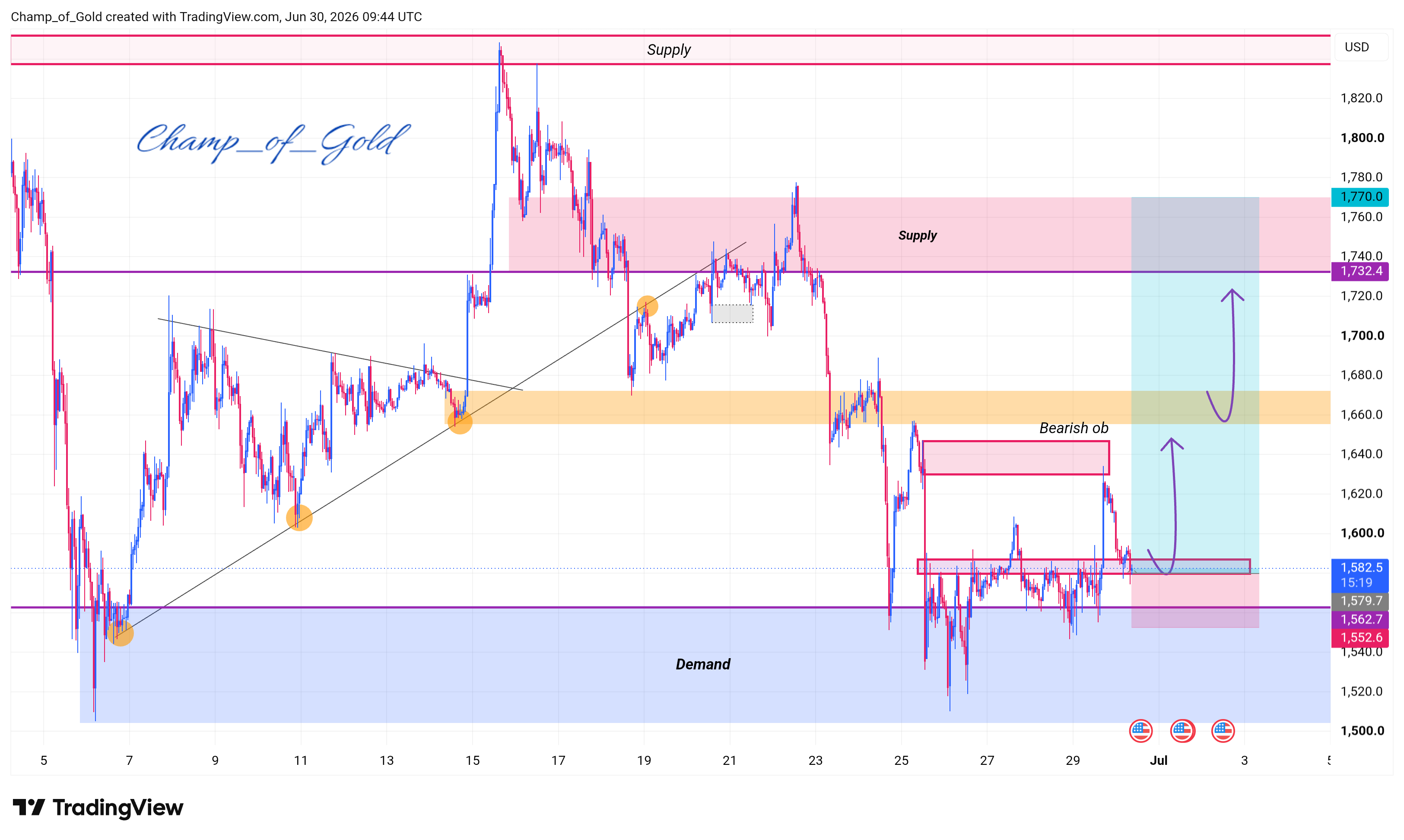 BITSTAMP:ETHUSD Chart Image by Champ_of_Gold