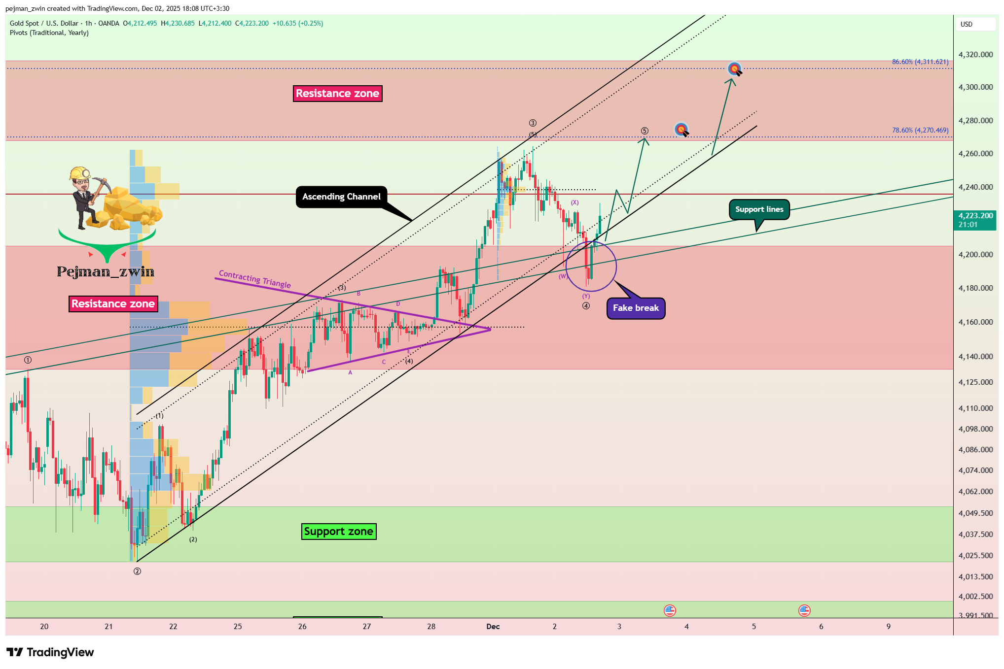 OANDA:XAUUSD Chart Image by pejman_zwin