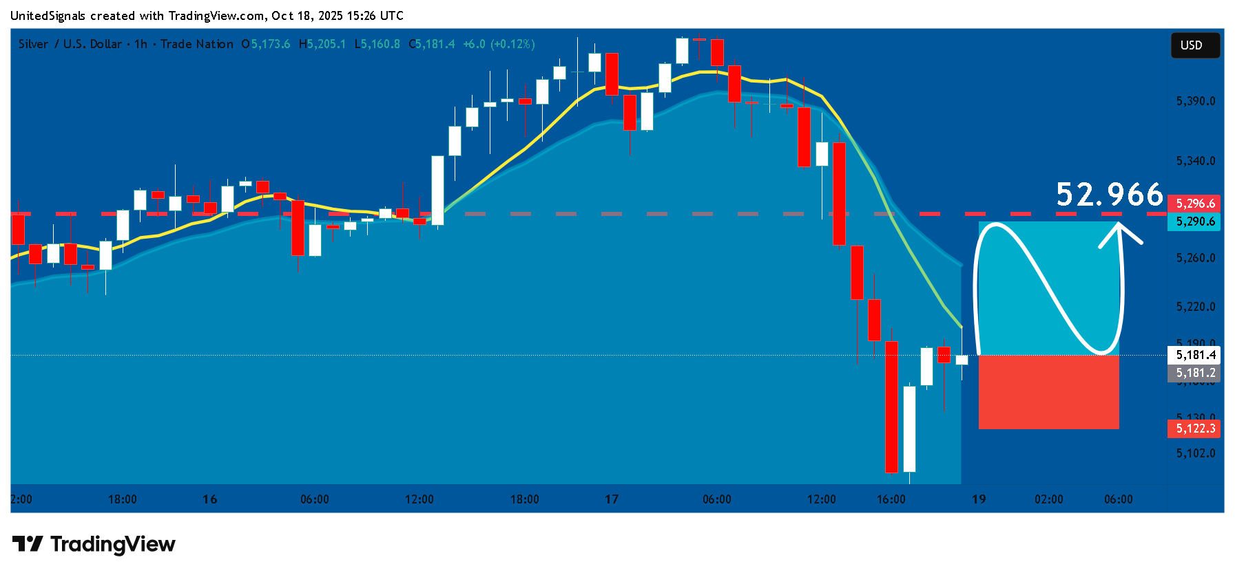 TRADENATION:XAGUSD Chart Image by UnitedSignals