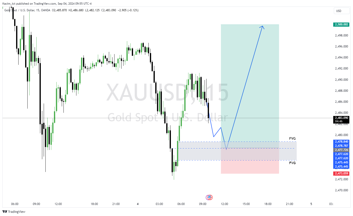 OANDA:XAUUSD Chart Image by Kacim_ict