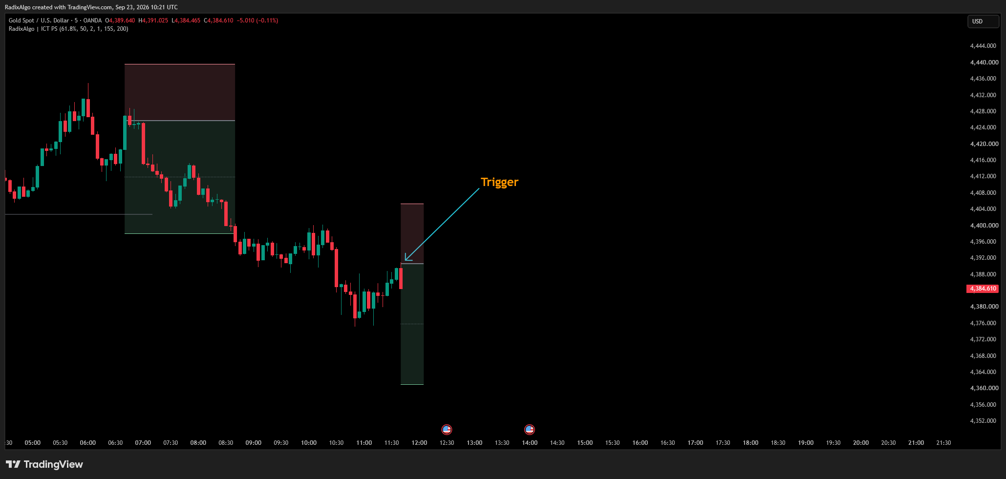 OANDA:XAUUSD Chart Image by RadixAlgo