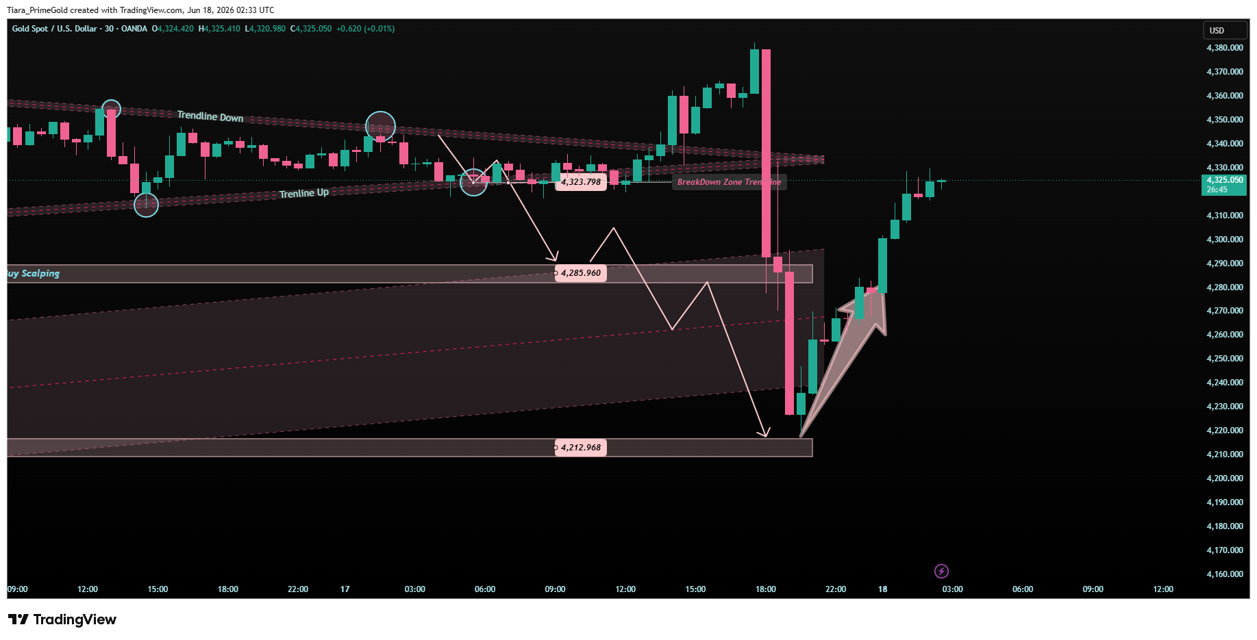 OANDA:XAUUSD Chart Image by Tiara_PrimeGold