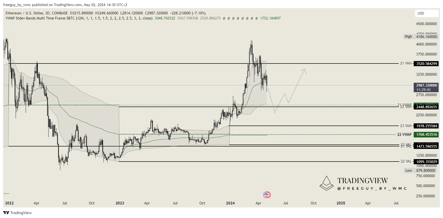 COINBASE:ETHUSD Chart Image by freeguy_by_wmc