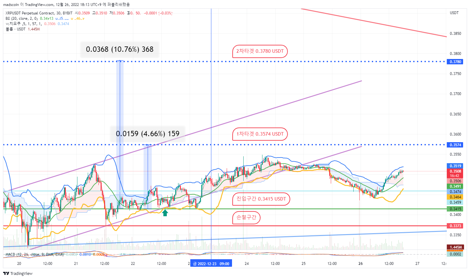 BYBIT:XRPUSDT.P Chart Image by madscoin