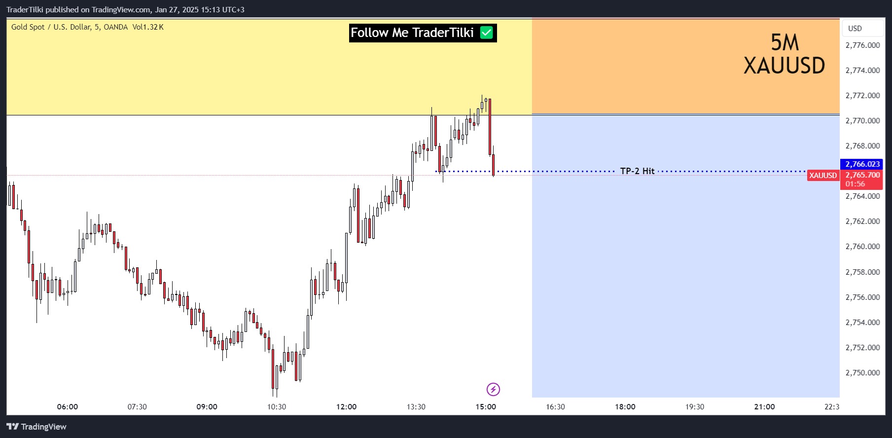 OANDA:XAUUSD Chart Image by TraderTilki