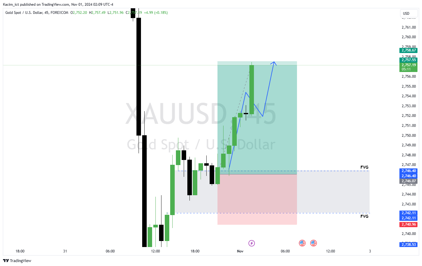FOREXCOM:XAUUSD Chart Image by Kacim_ict