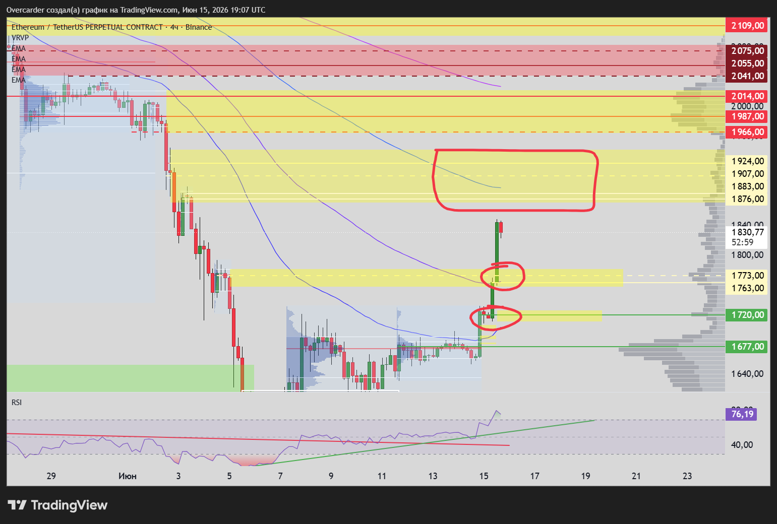 BINANCE:ETHUSDT.P Chart Image by Overcarder