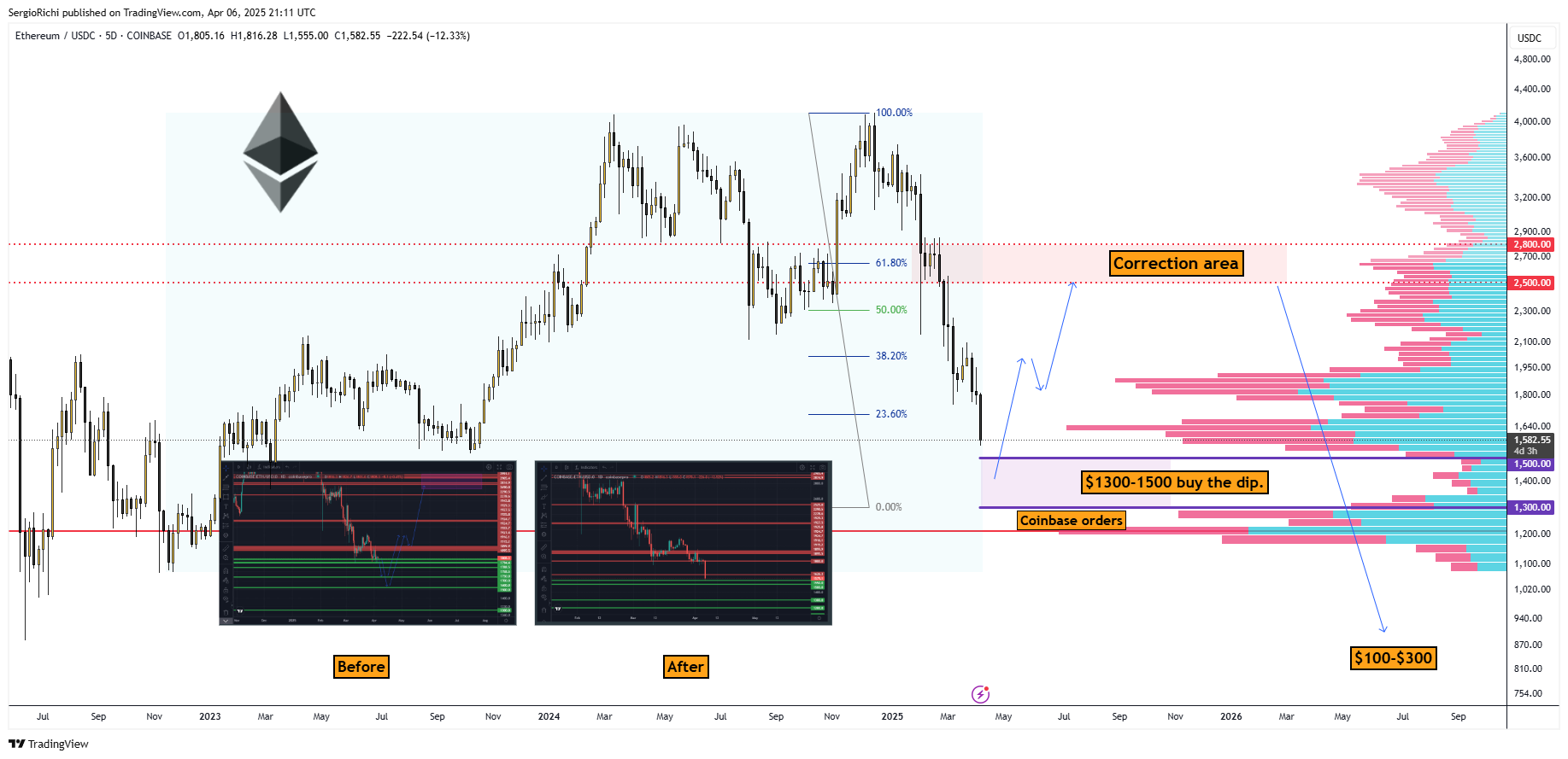 COINBASE:ETHUSDC Chart Image by StockWhaleX