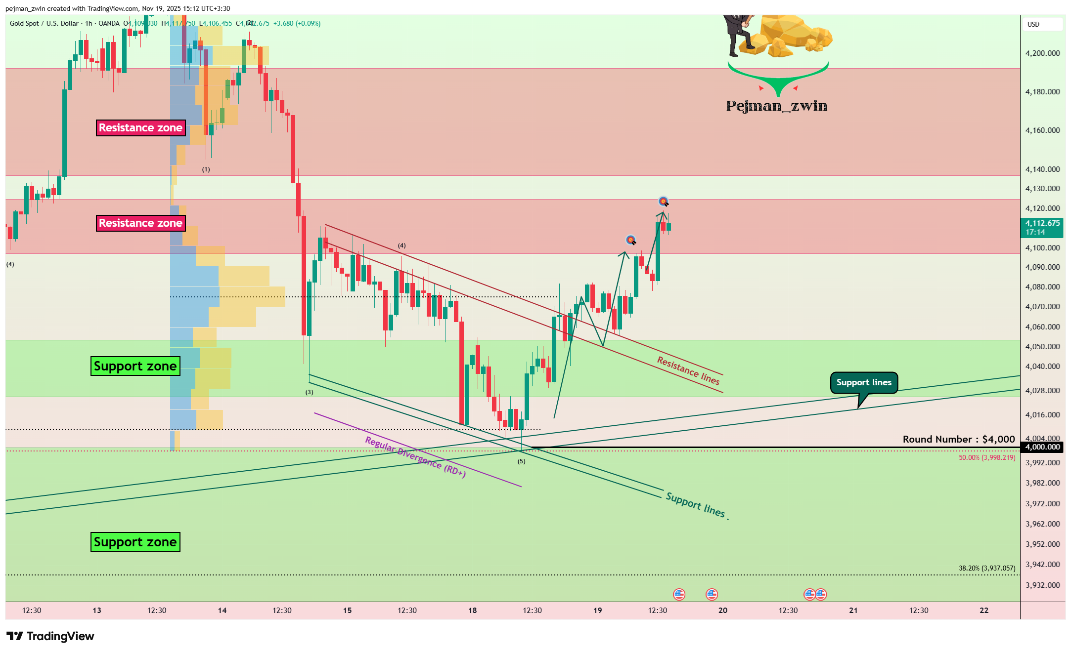 OANDA:XAUUSD 차트 이미지 - pejman_zwin 제공
