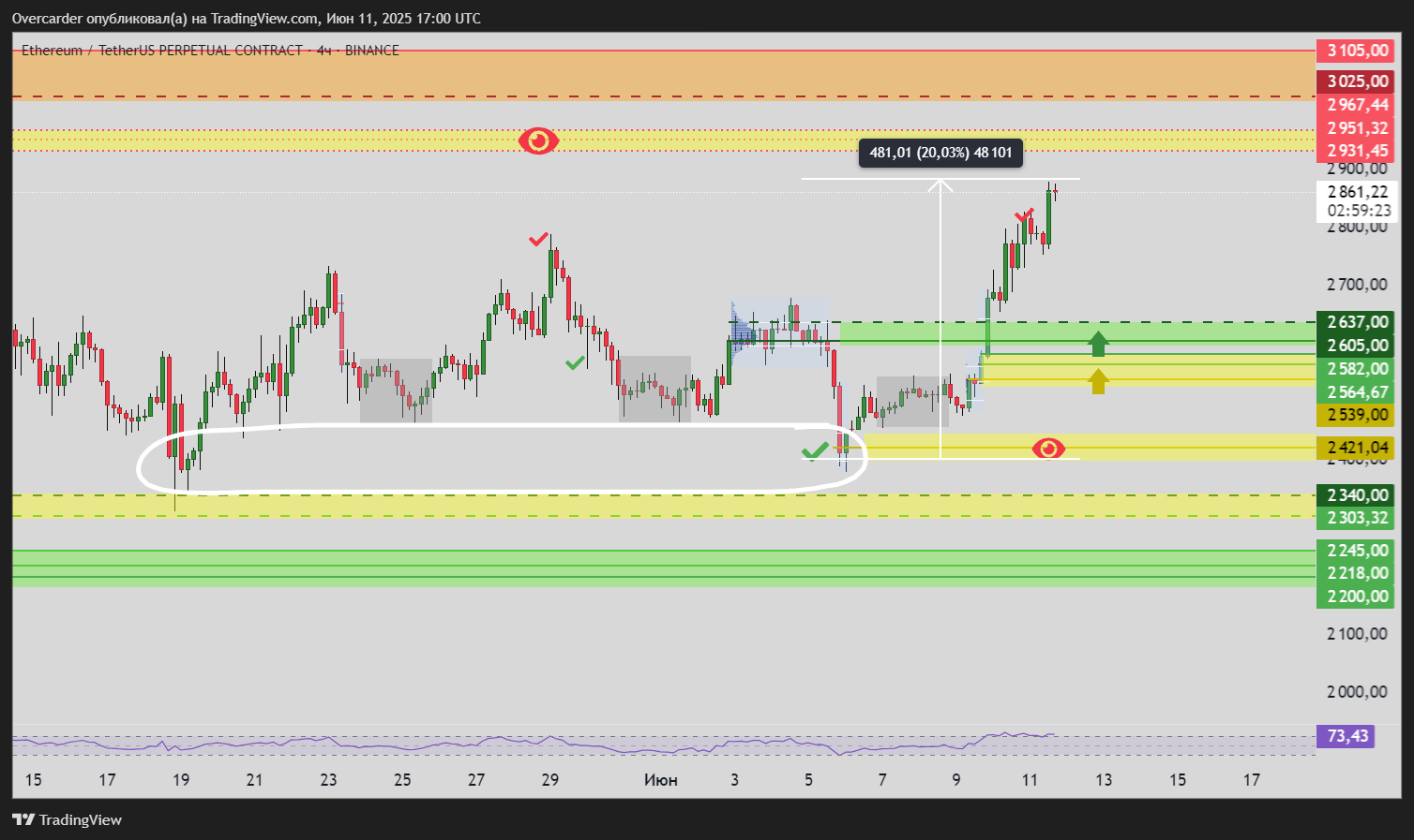 BINANCE:ETHUSDT.P Chart Image by Overcarder