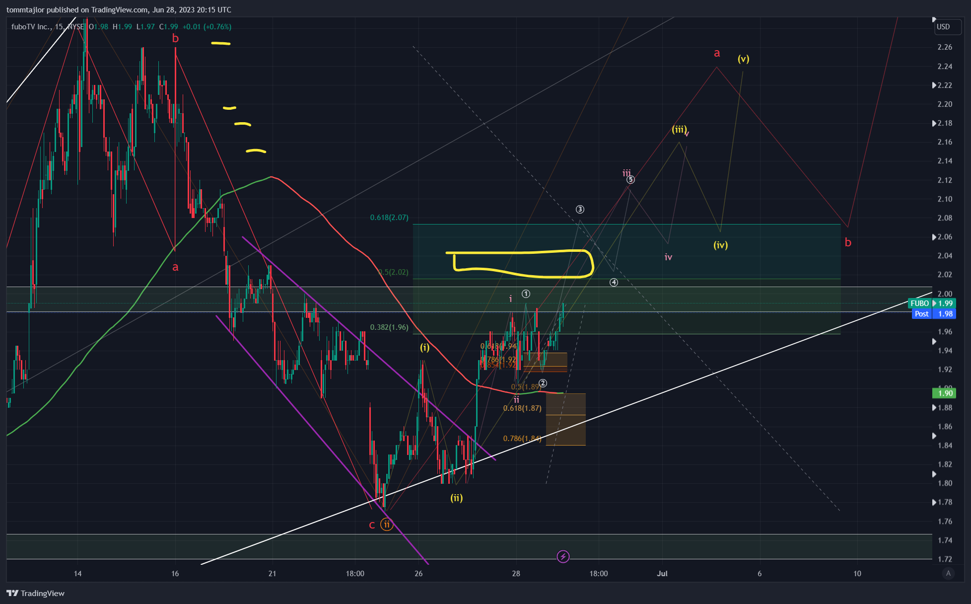 NYSE:FUBO 圖表圖片 由 tommtajlor 提供