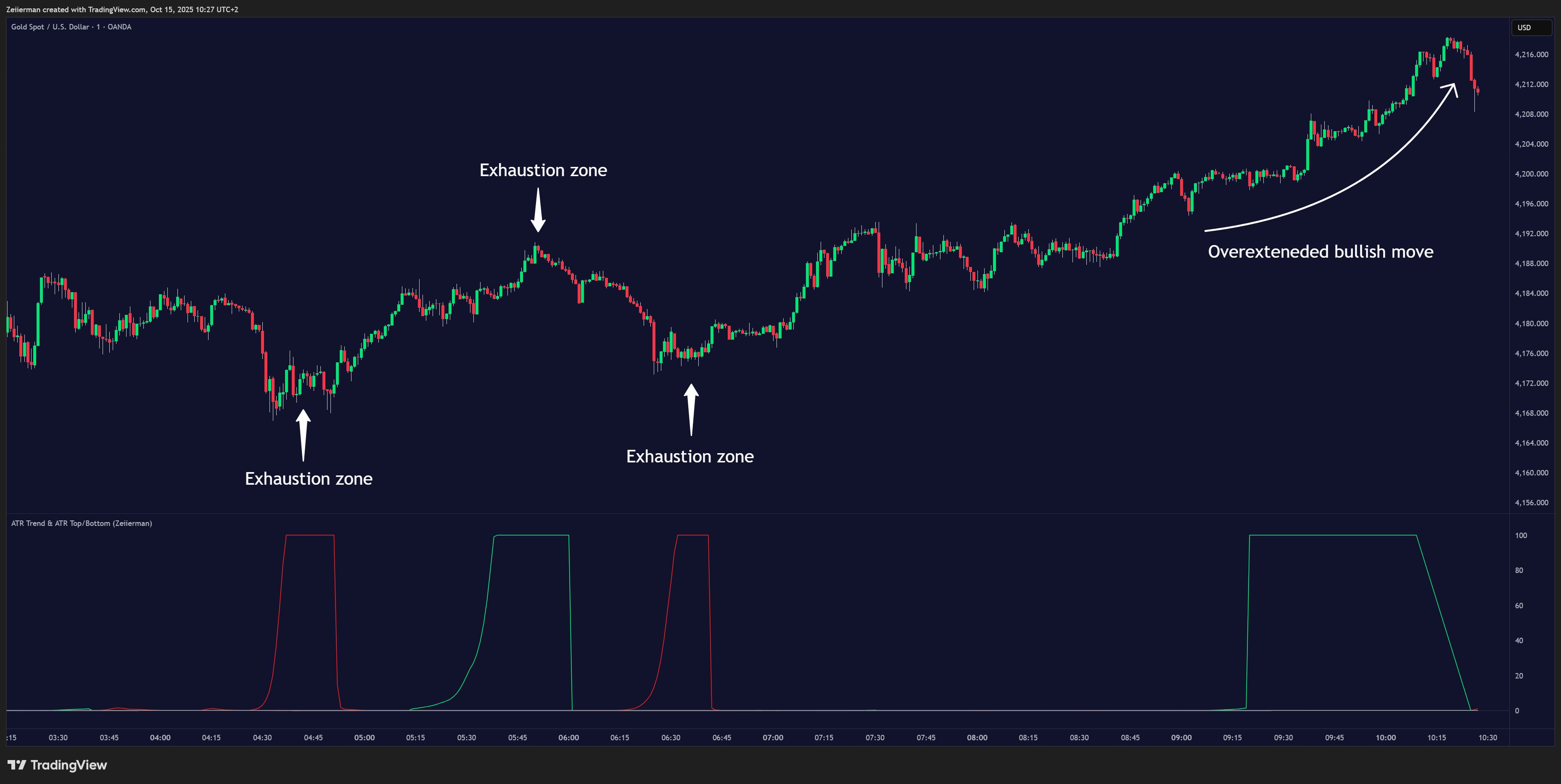OANDA:XAUUSD Chart Image by Zeiierman