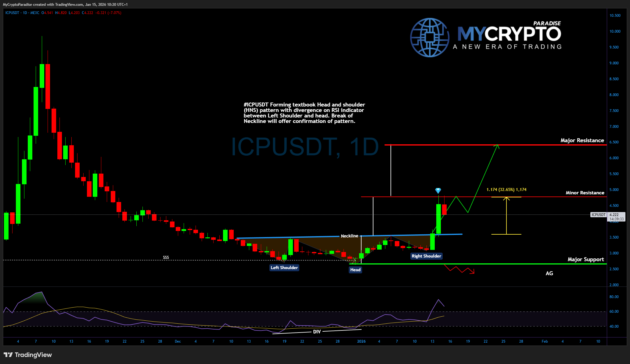 MEXC:ICPUSDT Imagem do gráfico por MyCryptoParadise