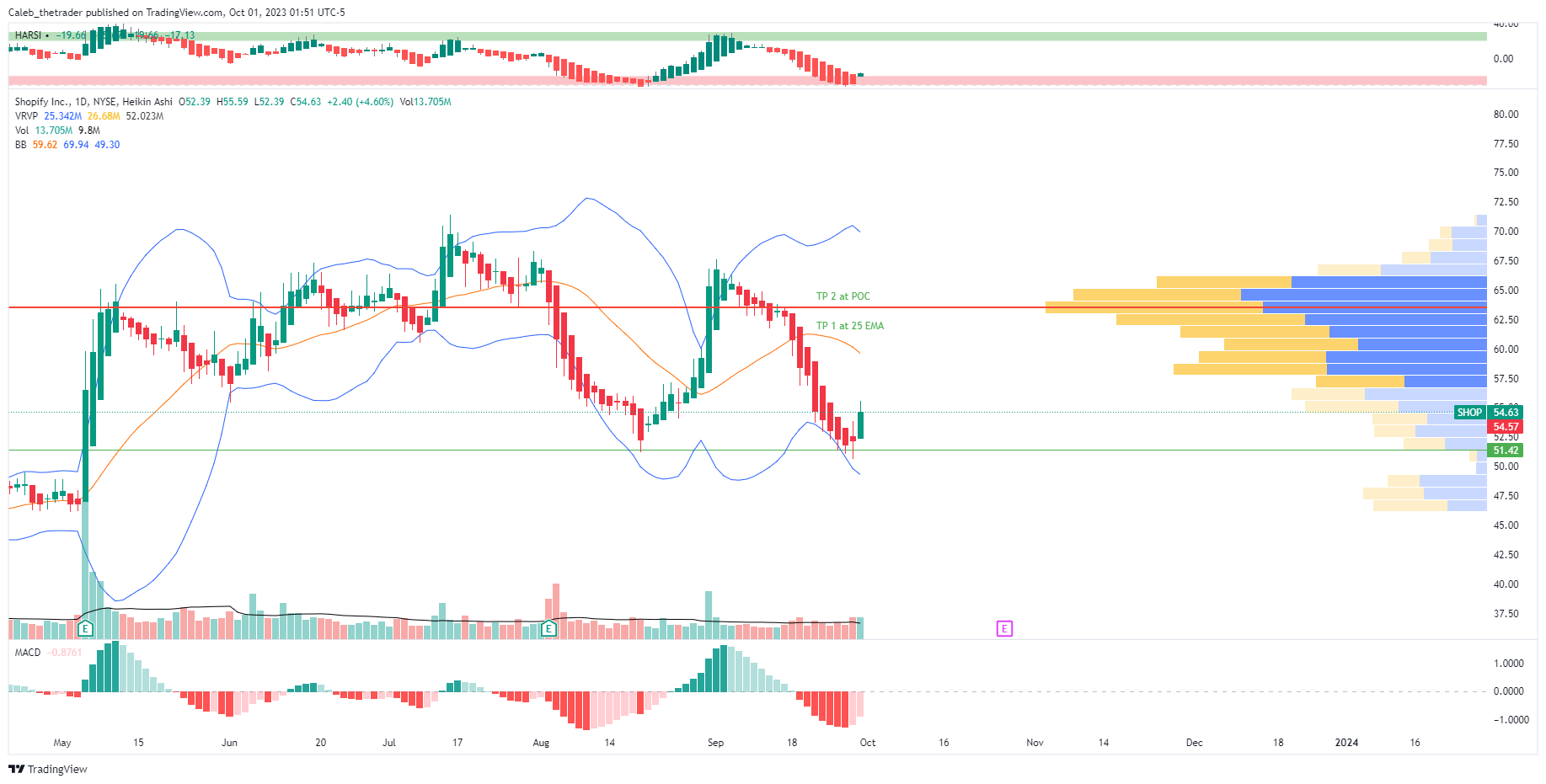 NYSE:SHOP Chart Image by OptionsMastery