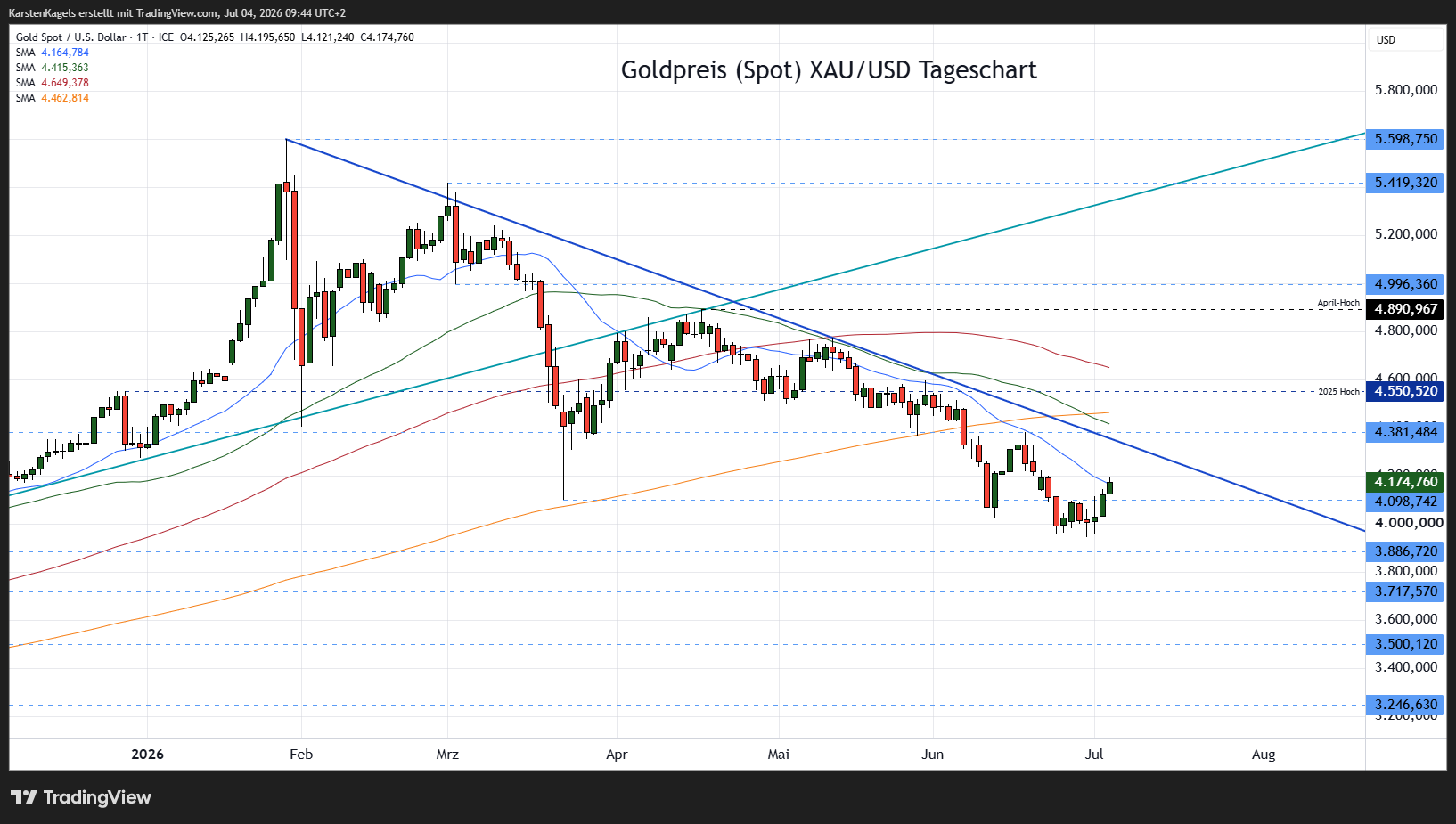 FX_IDC:XAUUSD Chart Image by KarstenKagels