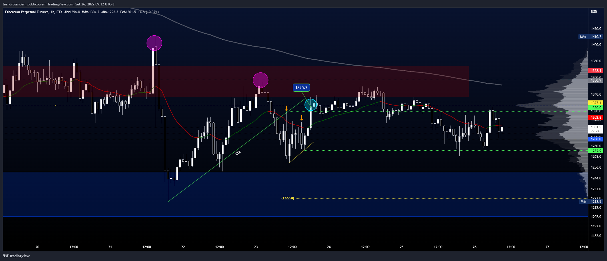 FTX:ETHPERP Chart Image by leandrosander_