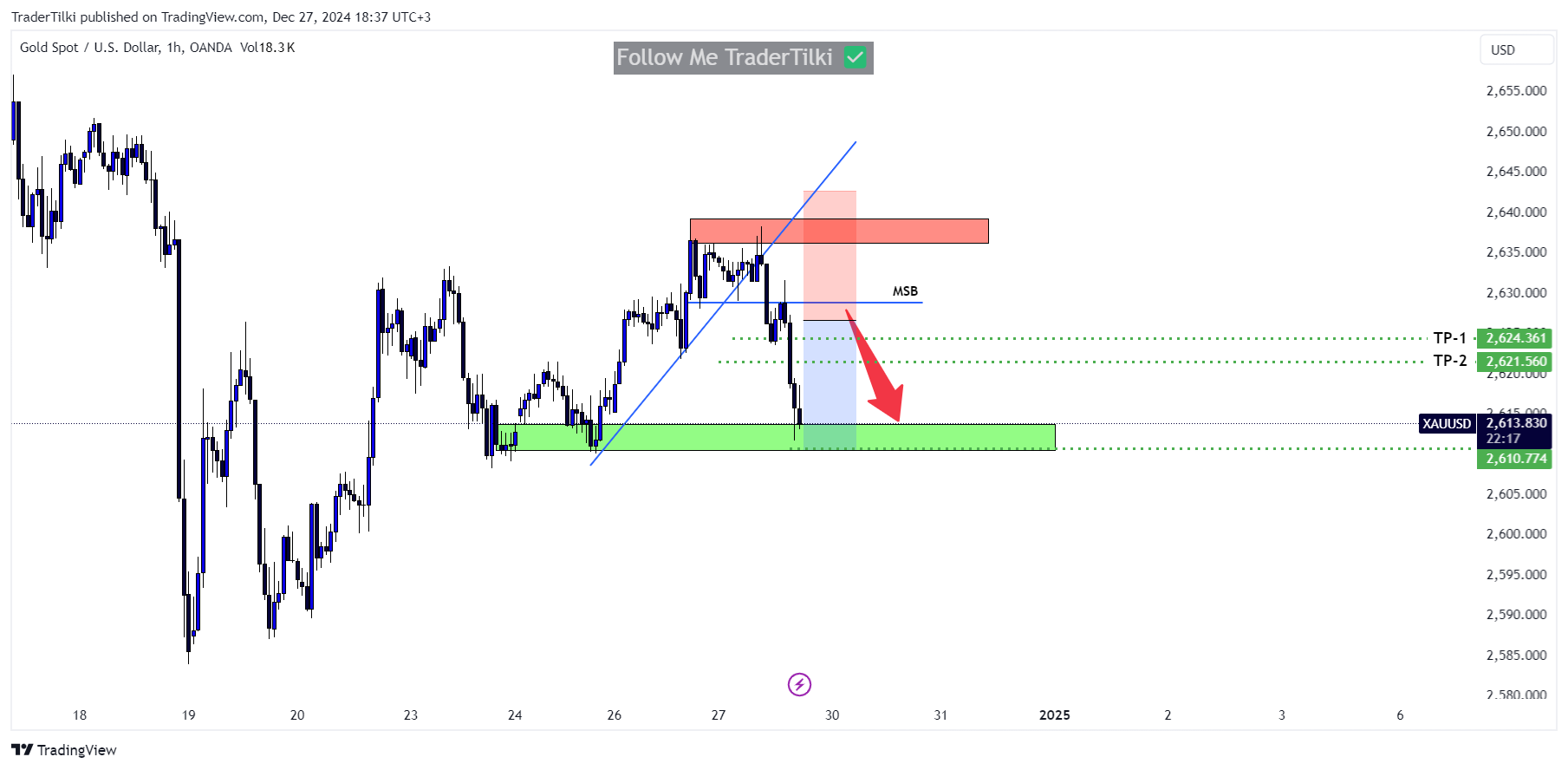 OANDA:XAUUSD Chart Image by TraderTilki