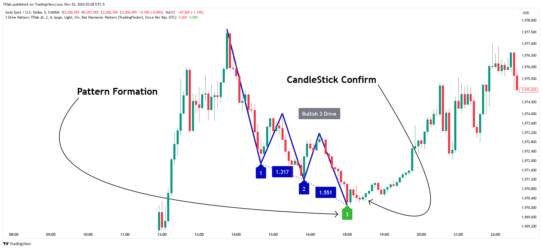 OANDA:XAUUSD Chart Image by TradingFinder