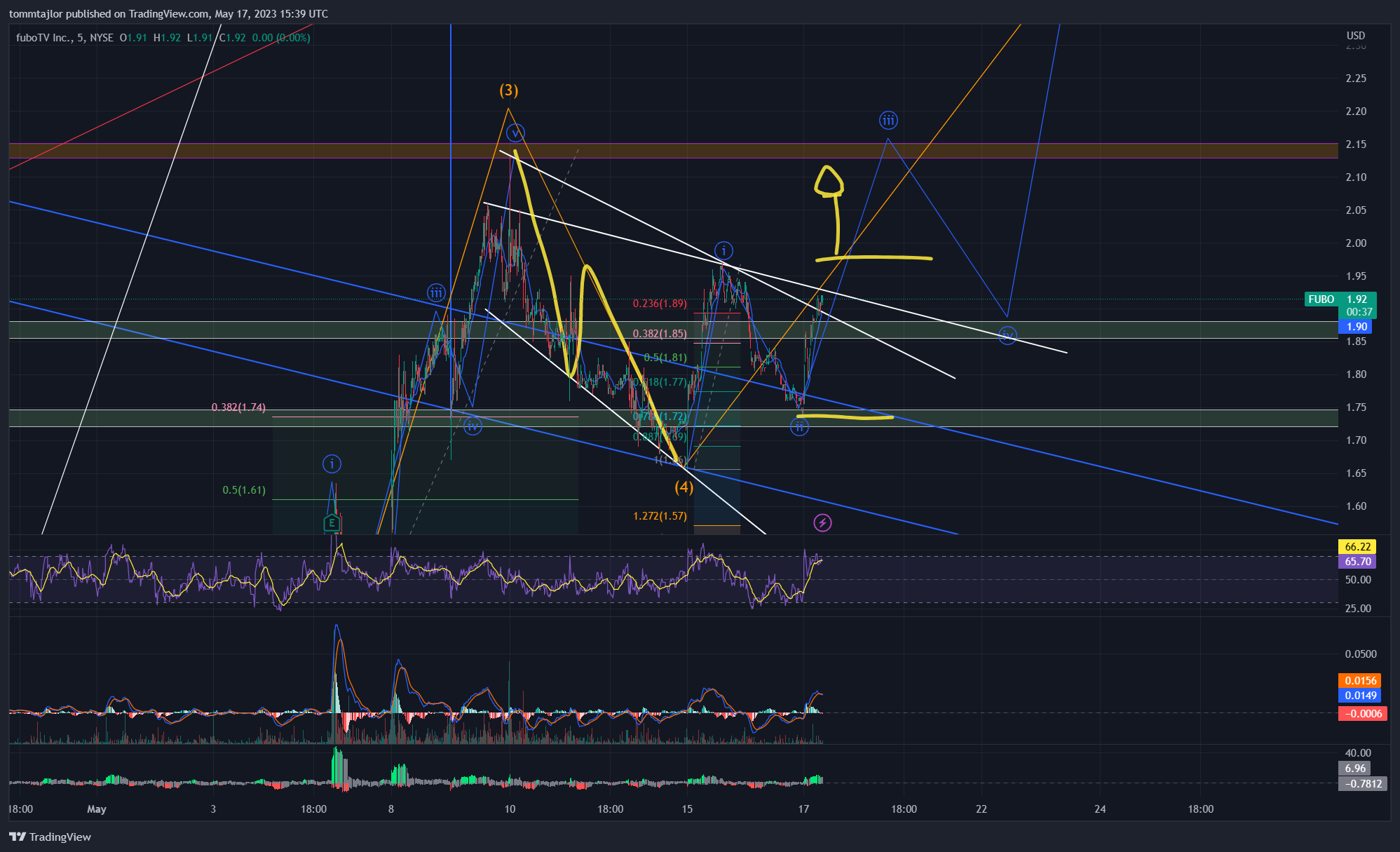 NYSE:FUBO 图表图片 由 tommtajlor 提供