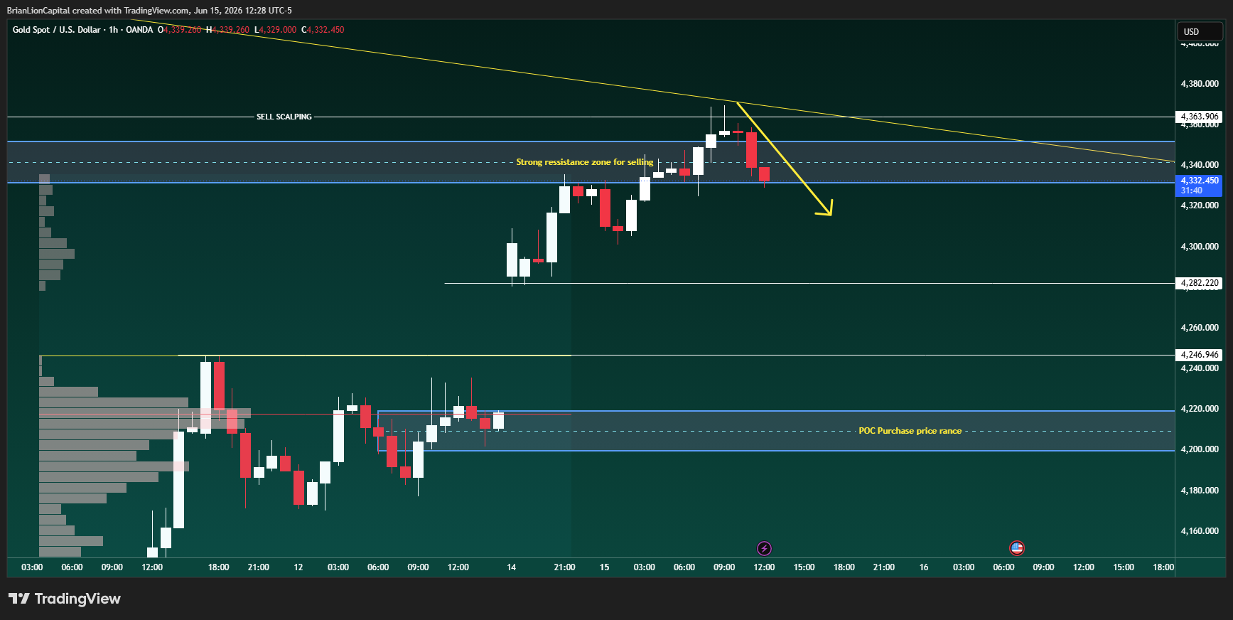 OANDA:XAUUSD Chart Image by BrianLionCapital