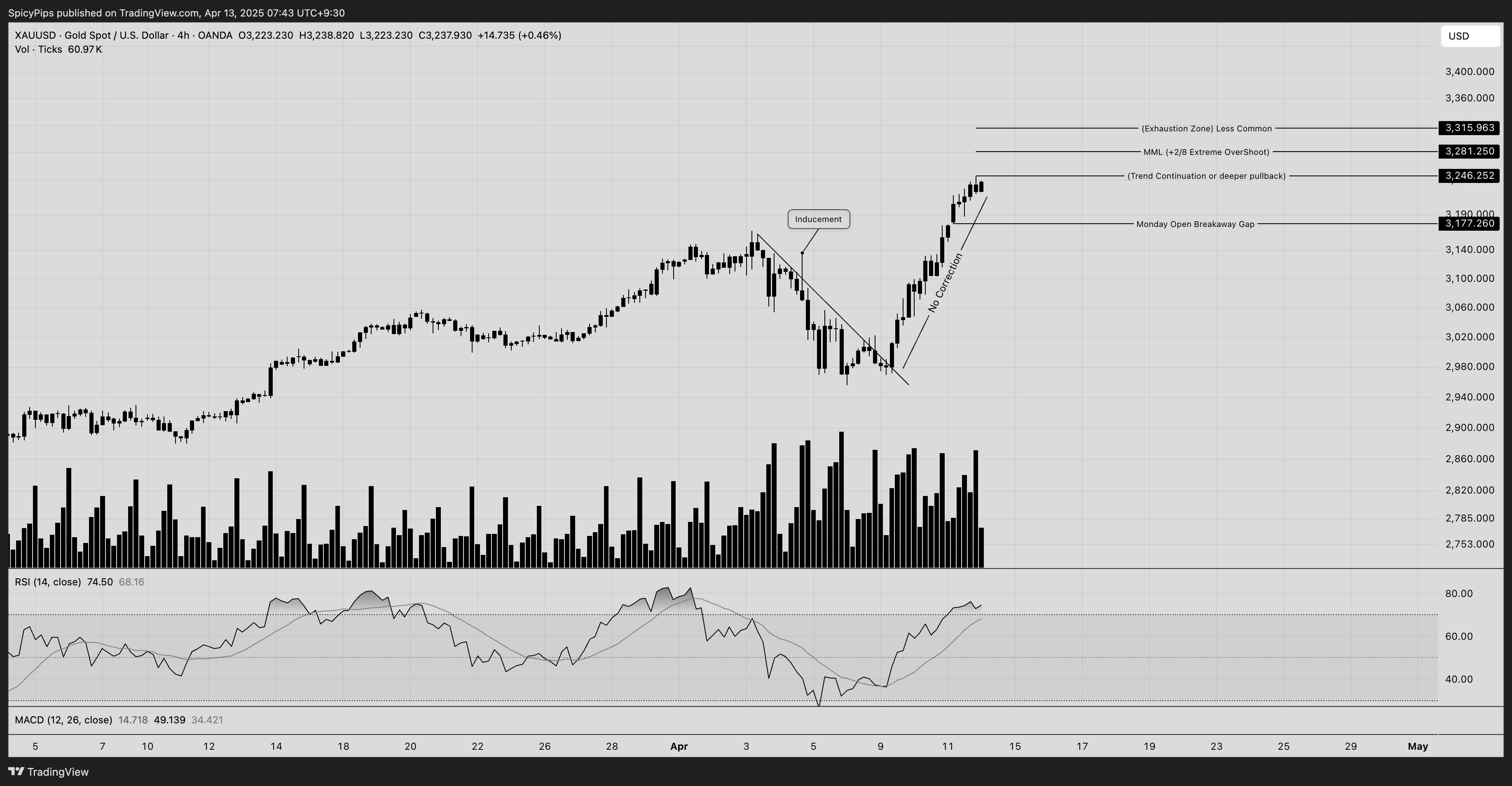 OANDA:XAUUSD Chart Image by Cabeero