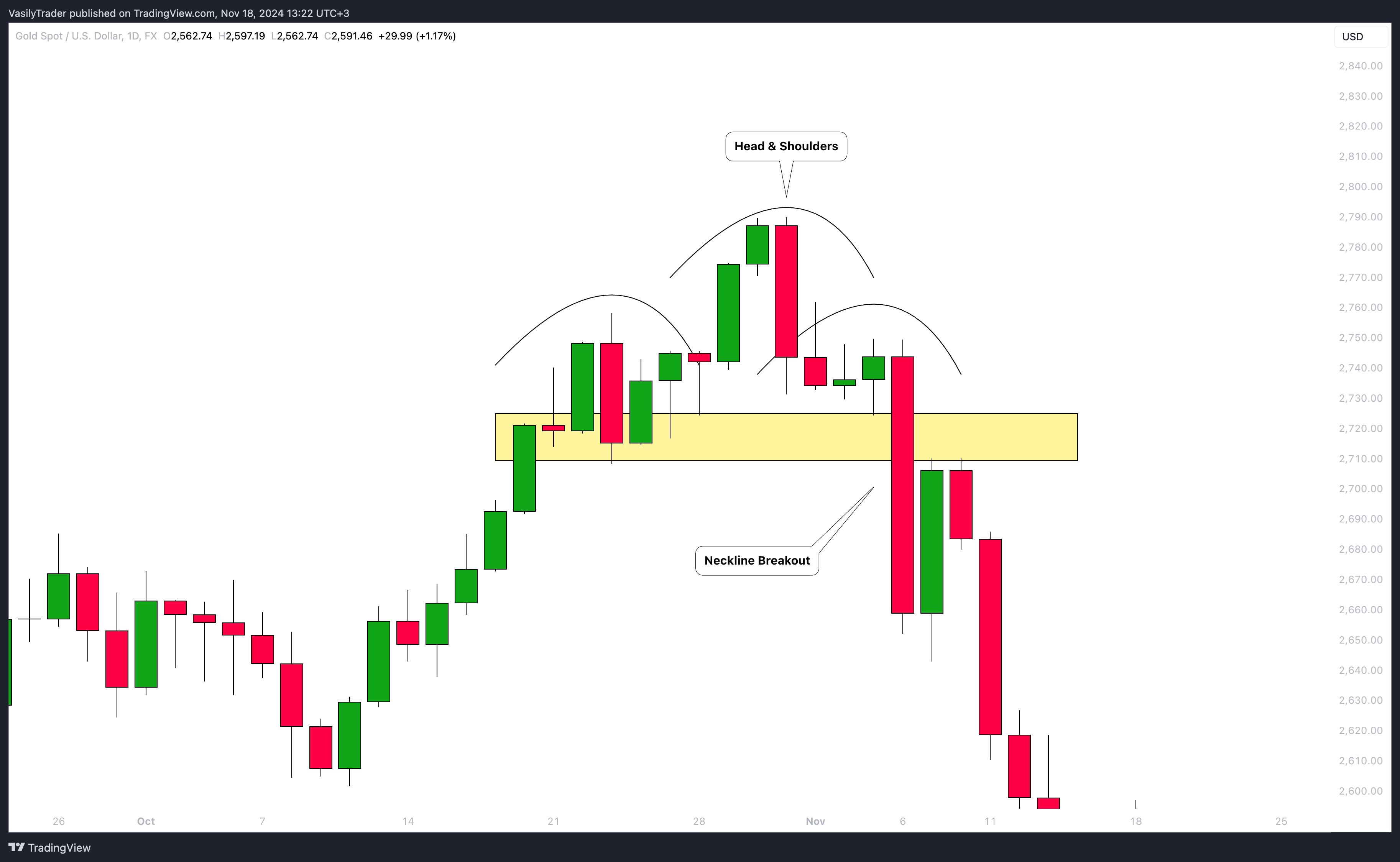 FX:XAUUSD Chart Image by VasilyTrader