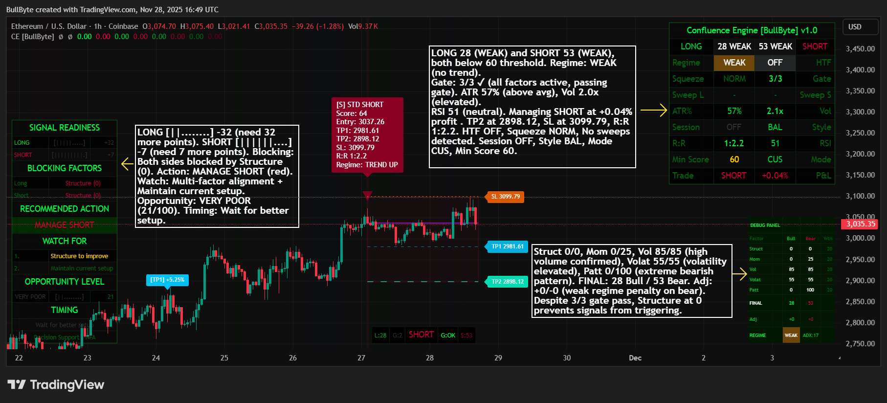 COINBASE:ETHUSD Chart Image by BullByte