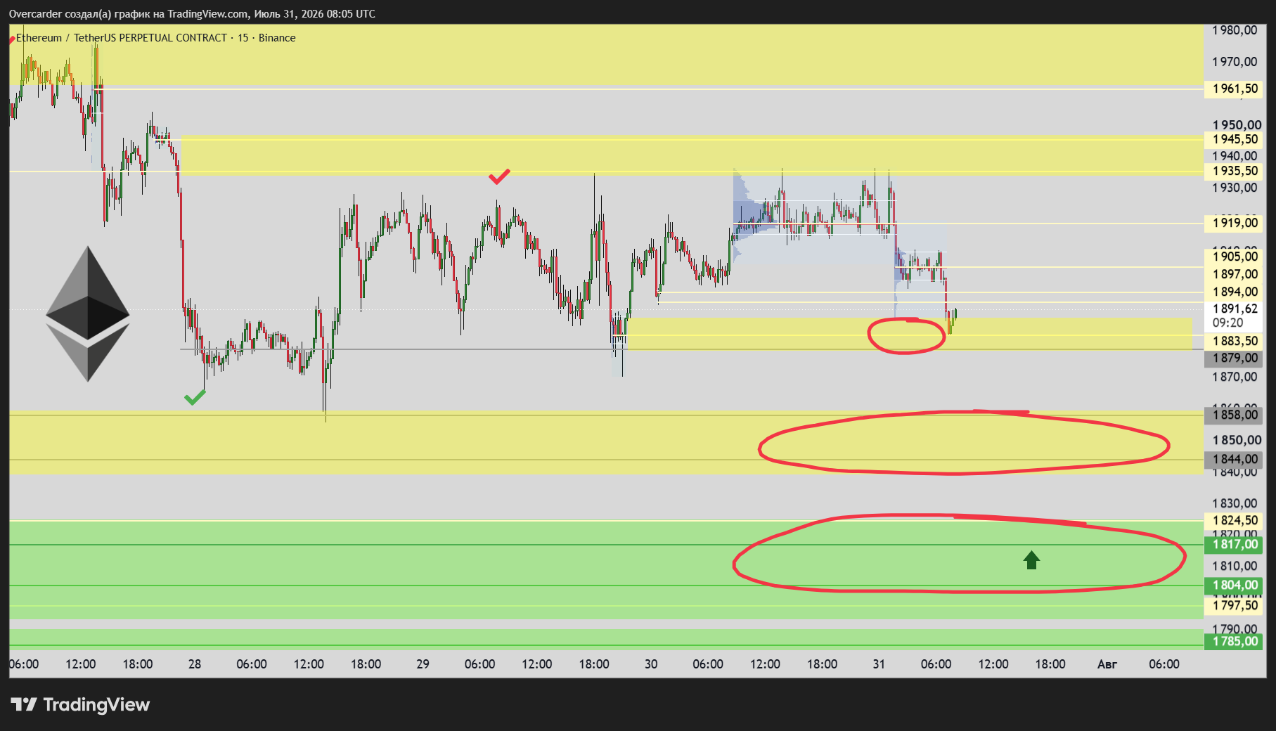 BINANCE:ETHUSDT.P Chart Image by Overcarder