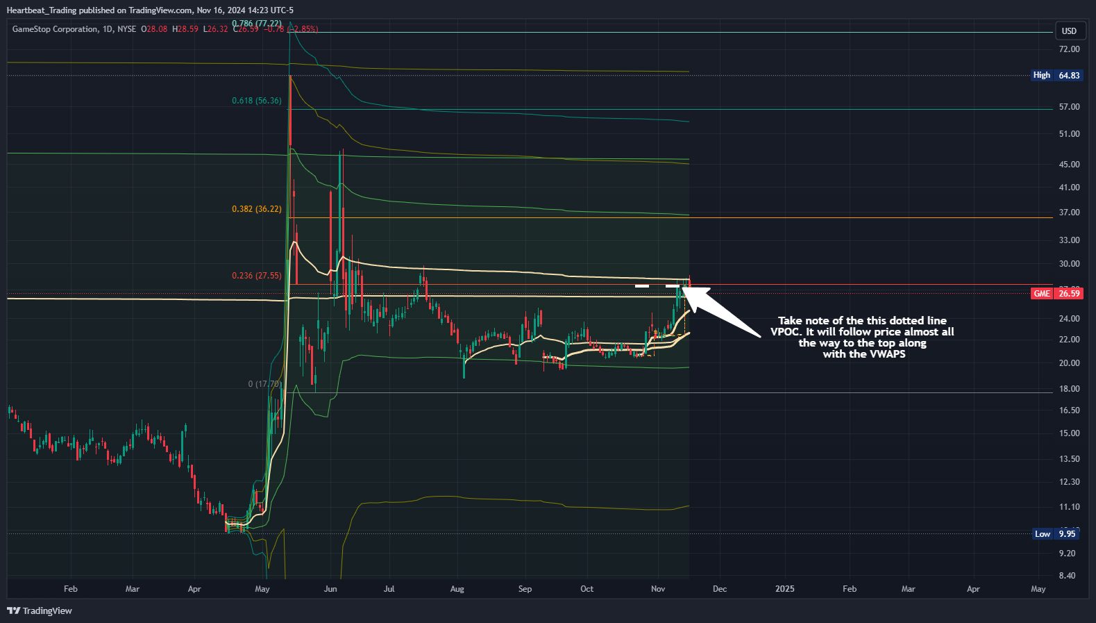 BATS:GME Chart Image by Heartbeat_Trading